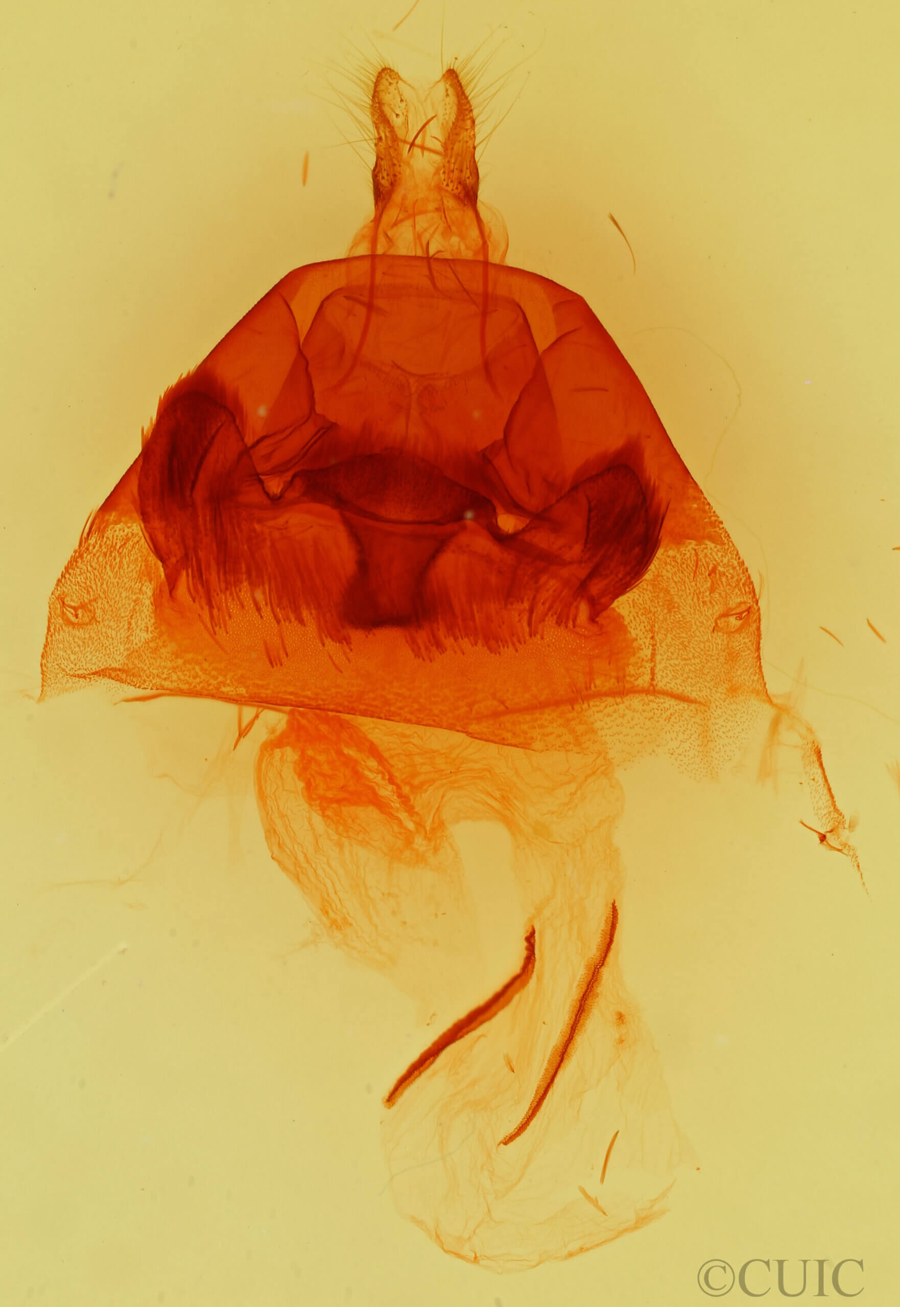 genitalia view of adult Hyppa xylinoides