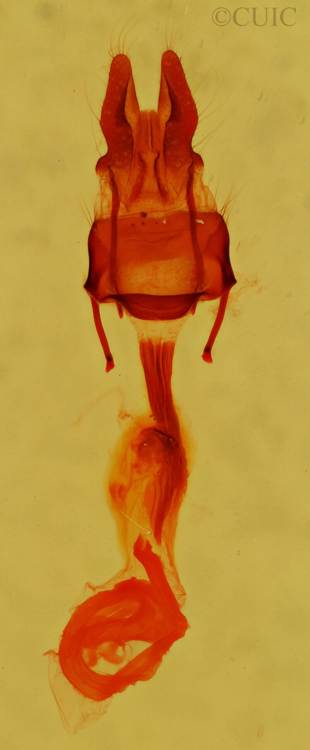 genitalia view of adult Hypocoena sp.