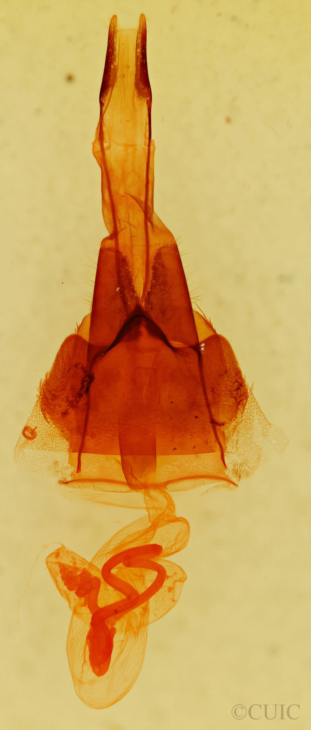 genitalia view of adult Protorthodes sp.
