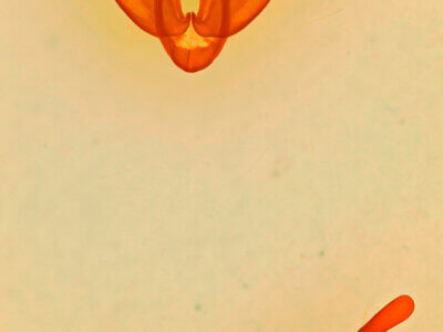 genitalia view of adult Ipimorpha sp.