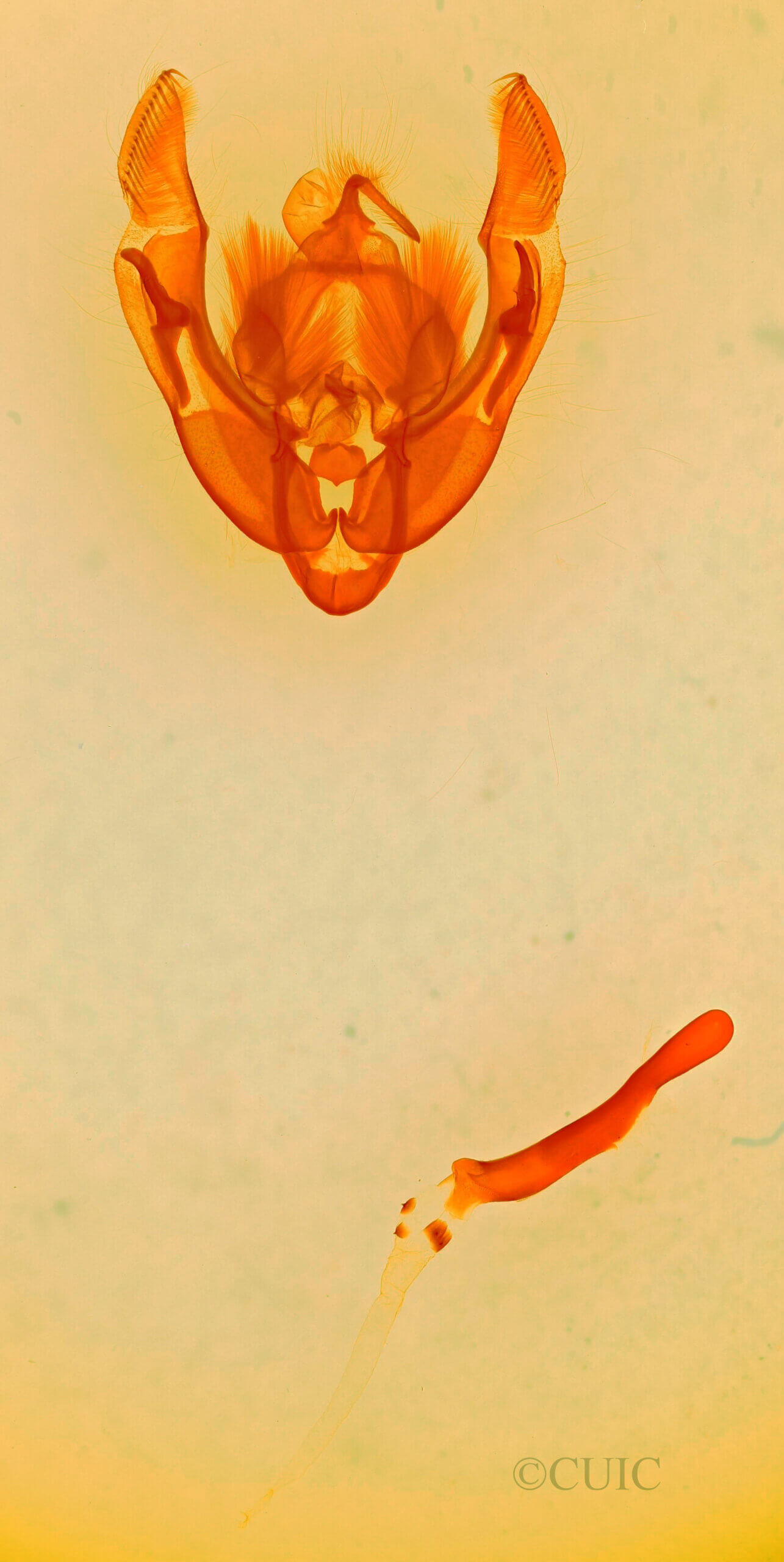 genitalia view of adult Ipimorpha sp.