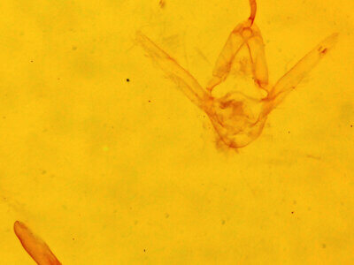 genitalia view of adult Hypenodes sp.