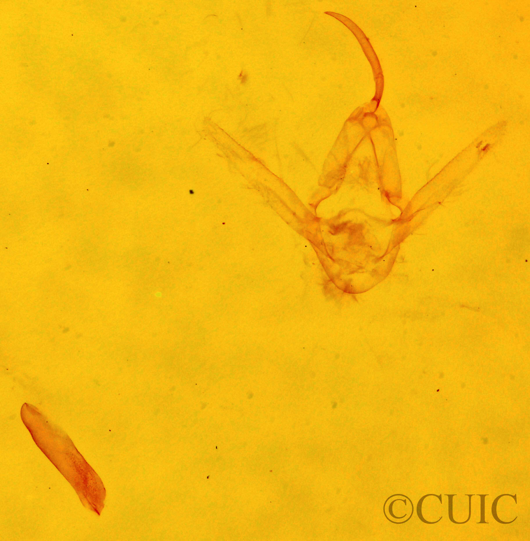 genitalia view of adult Hypenodes sp.