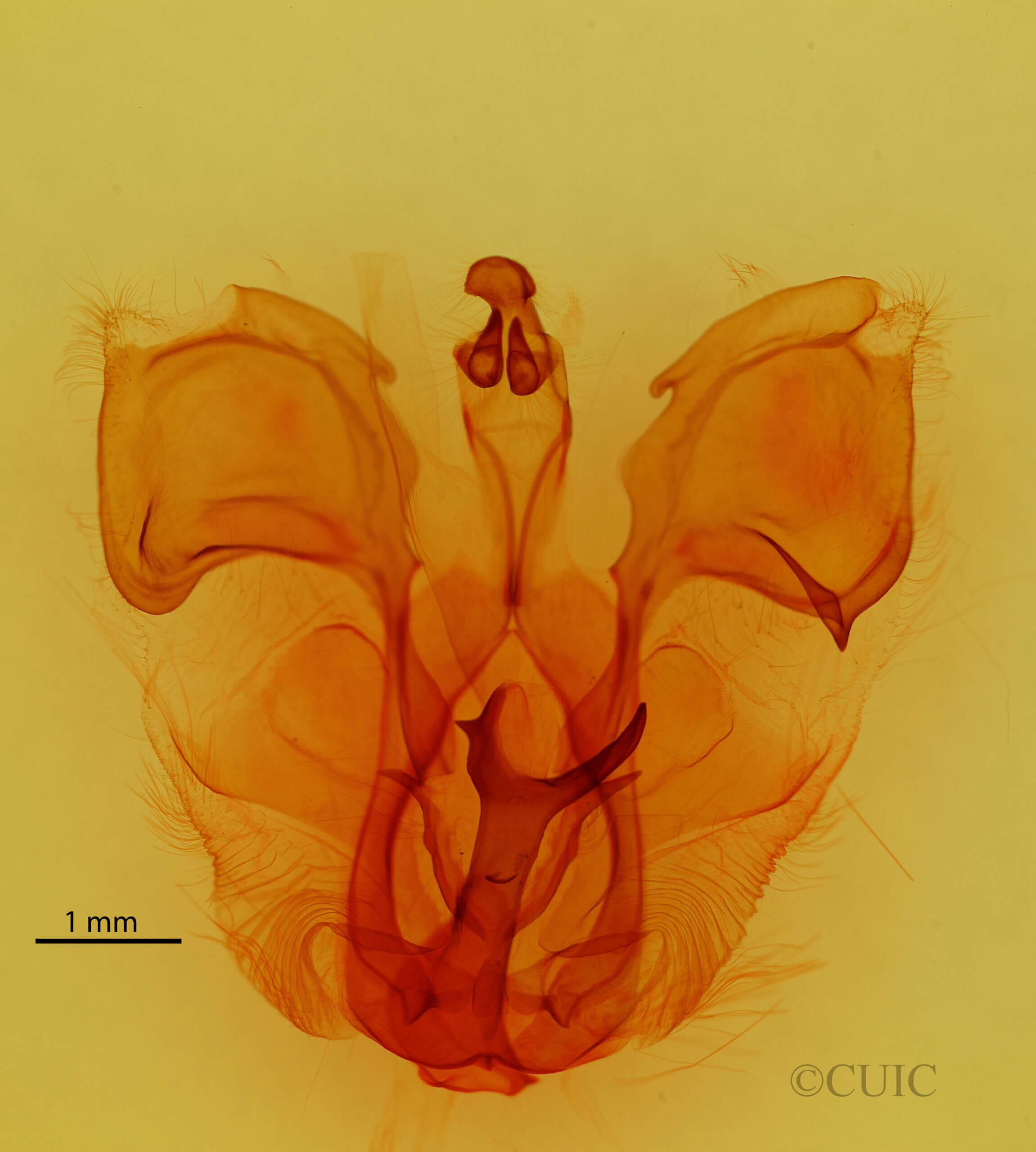 genitalia view of adult Pentobesa sinistra