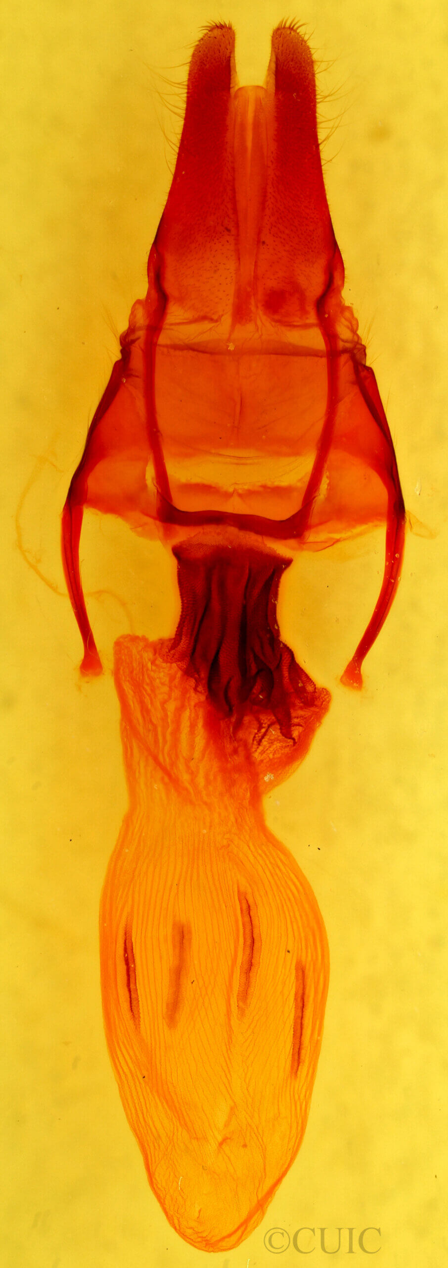 genitalia view of adult Apamea lateritia