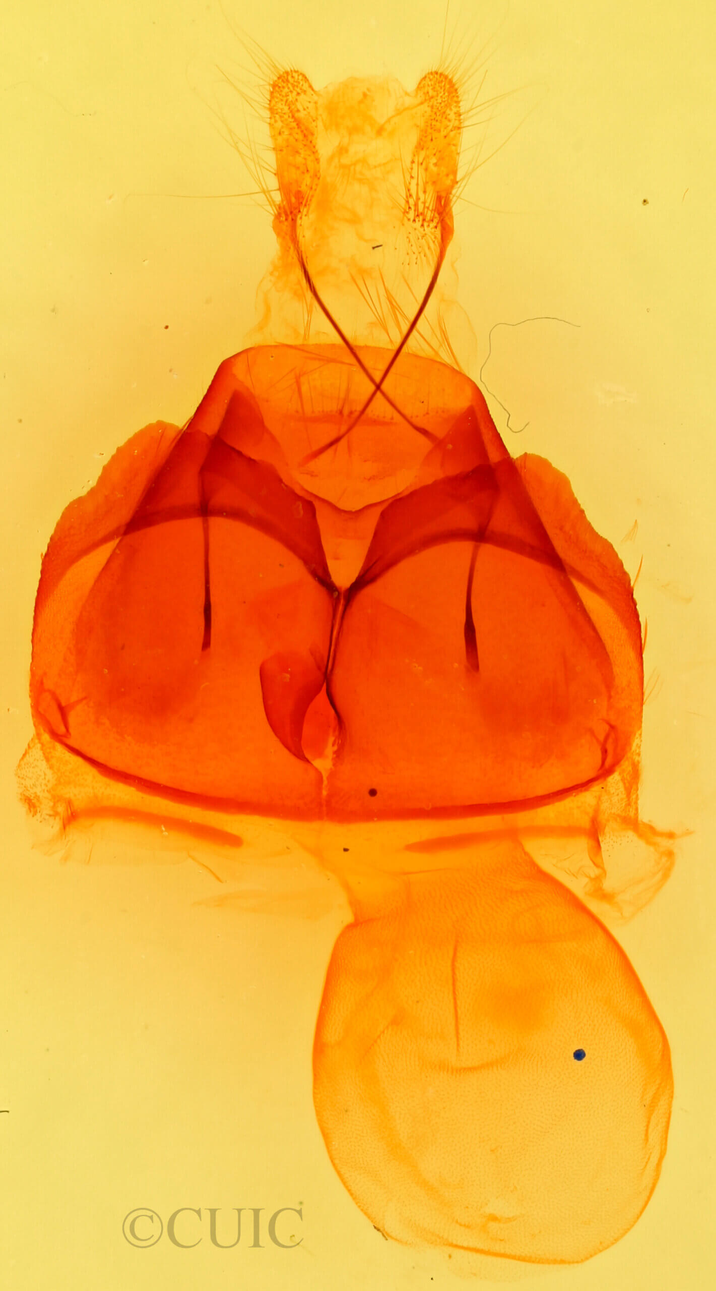 genitalia view of adult Zale sp.