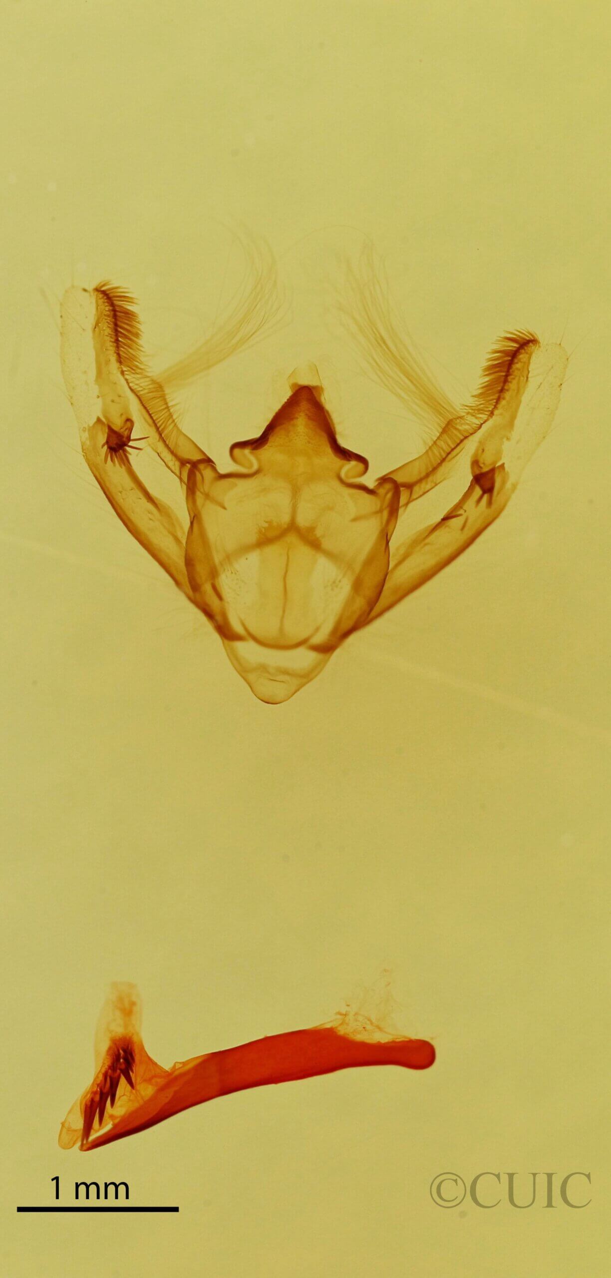 genitalia view of adult Galenara sp.