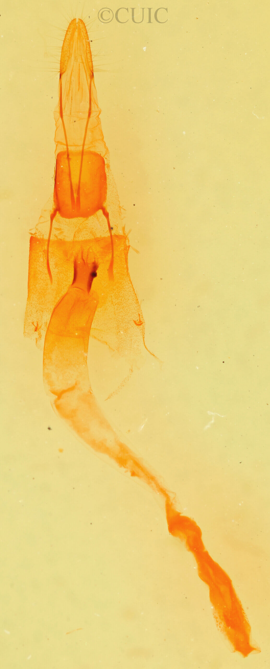 genitalia view of adult Galenara sp.
