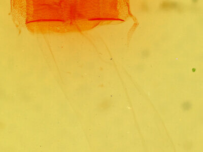 genitalia view of adult Condica sp.