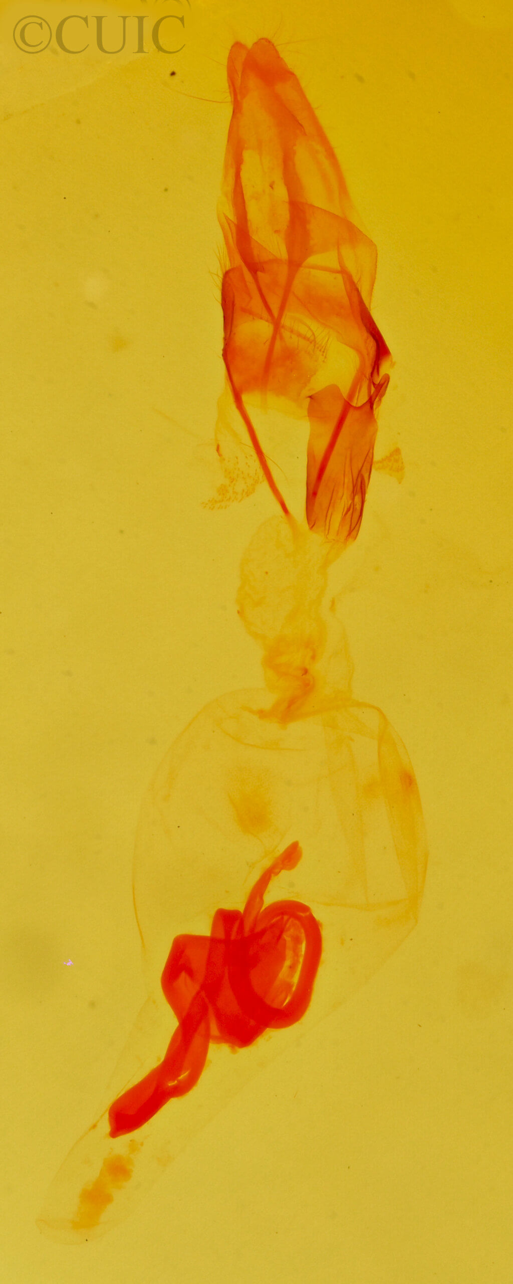 genitalia view of adult Xantholita n. gen.