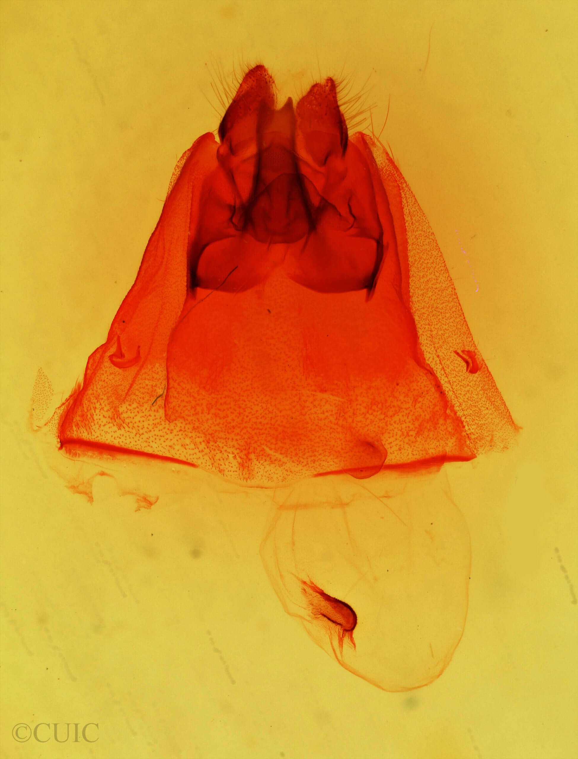 genitalia view of adult Euhyparpax rosea