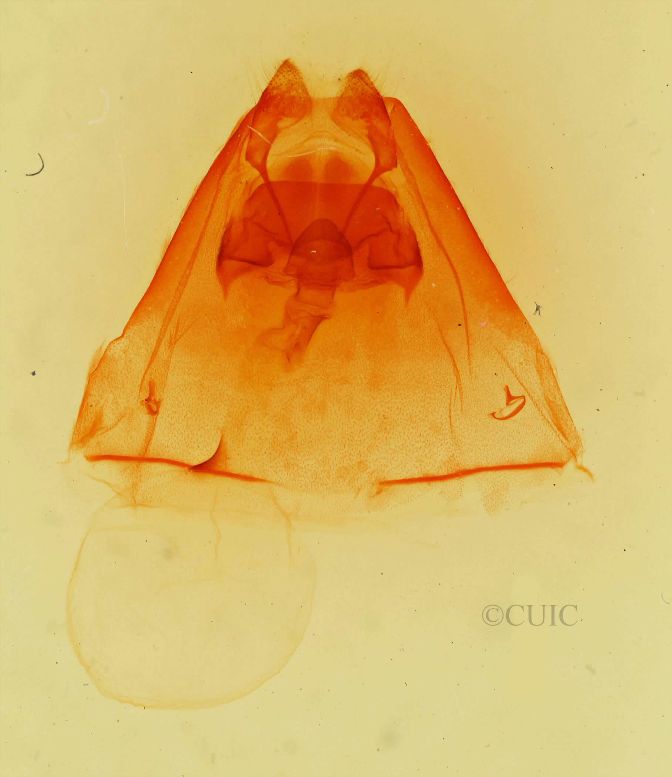 genitalia view of adult Hyparpax aurora