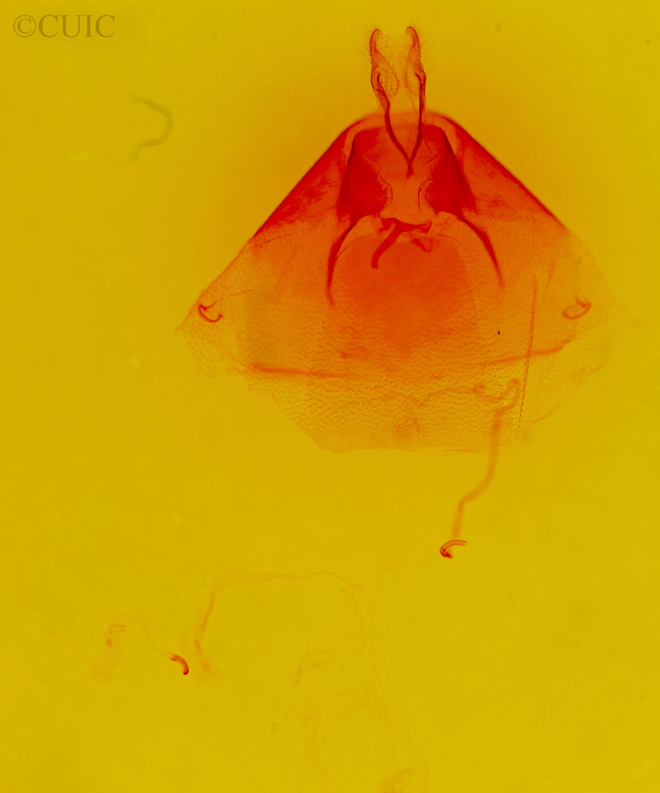 genitalia view of adult Eudryas unio