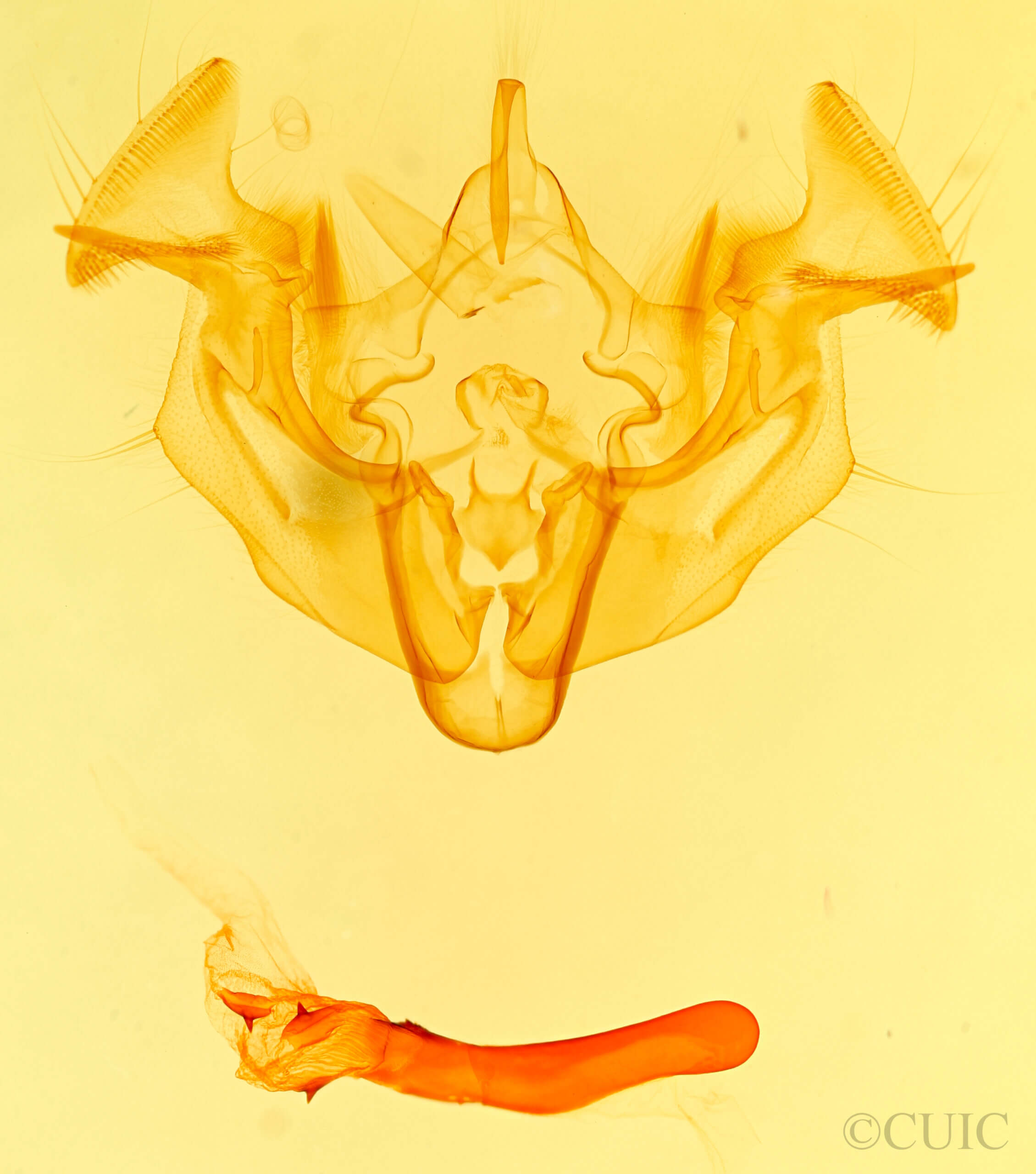 genitalia view of adult Apamea cogitata