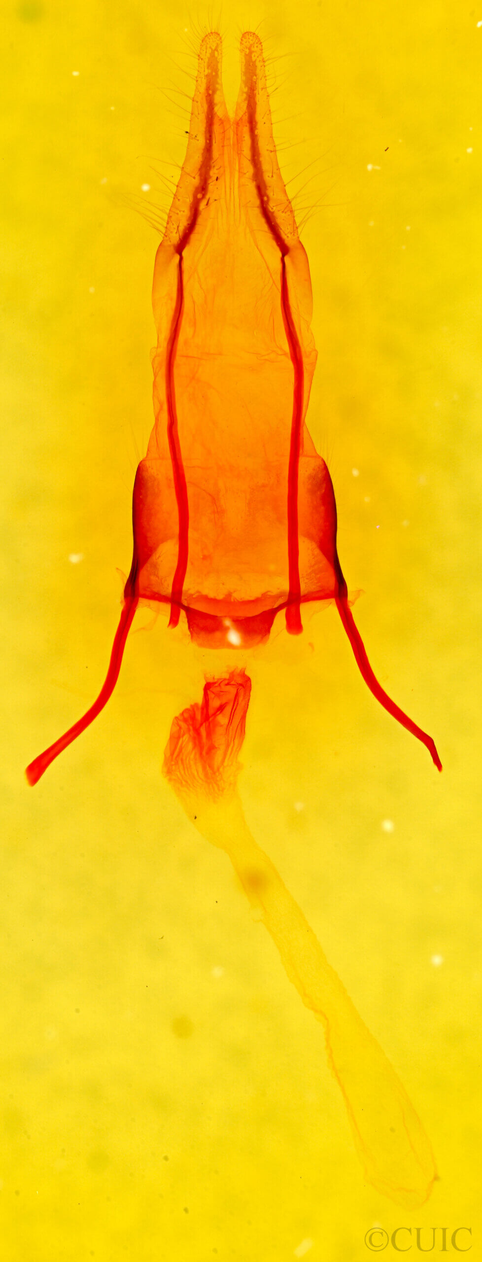 genitalia view of adult Eremobina leucoscelis