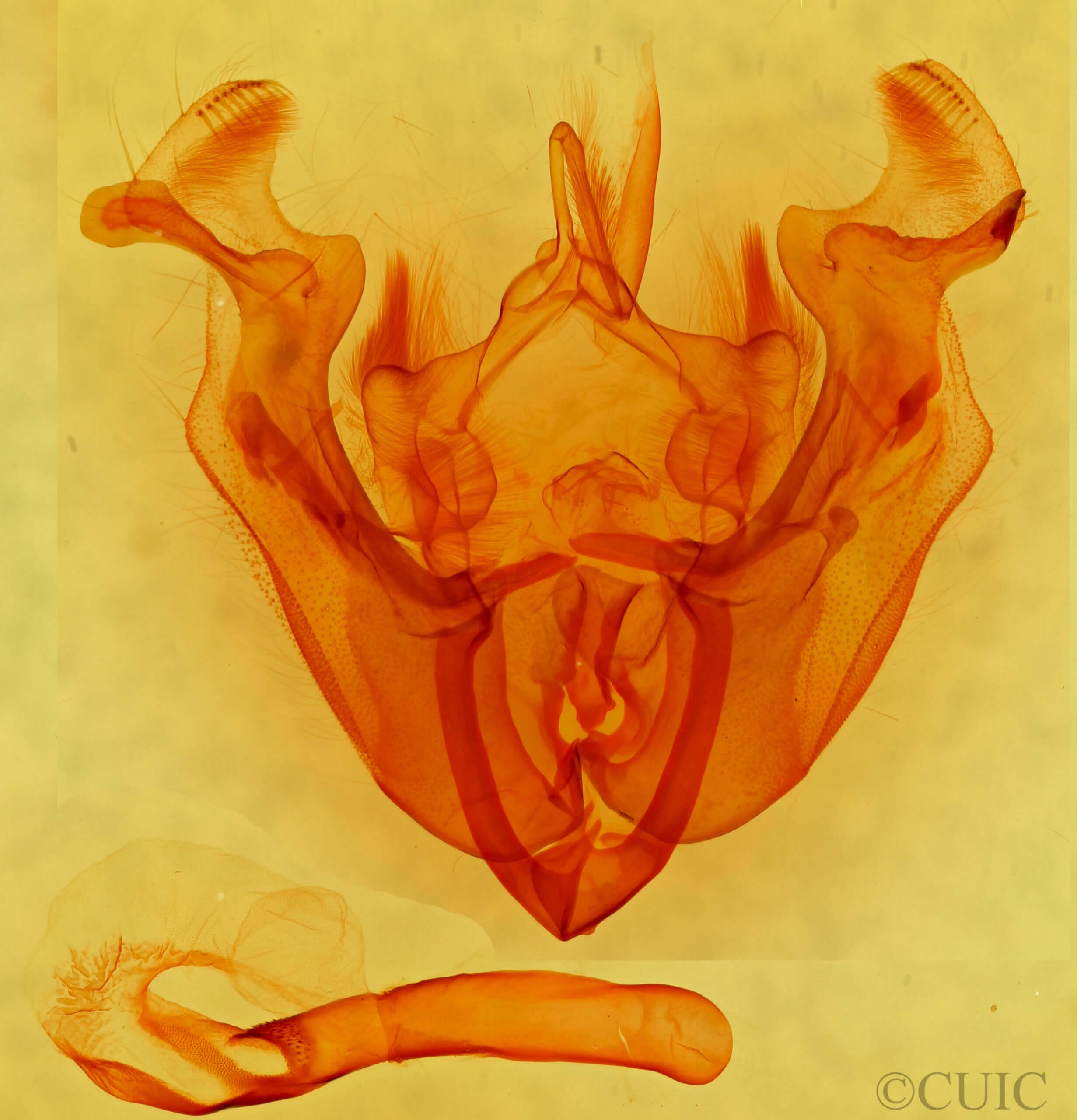 genitalia view of adult Apamea scolopacina