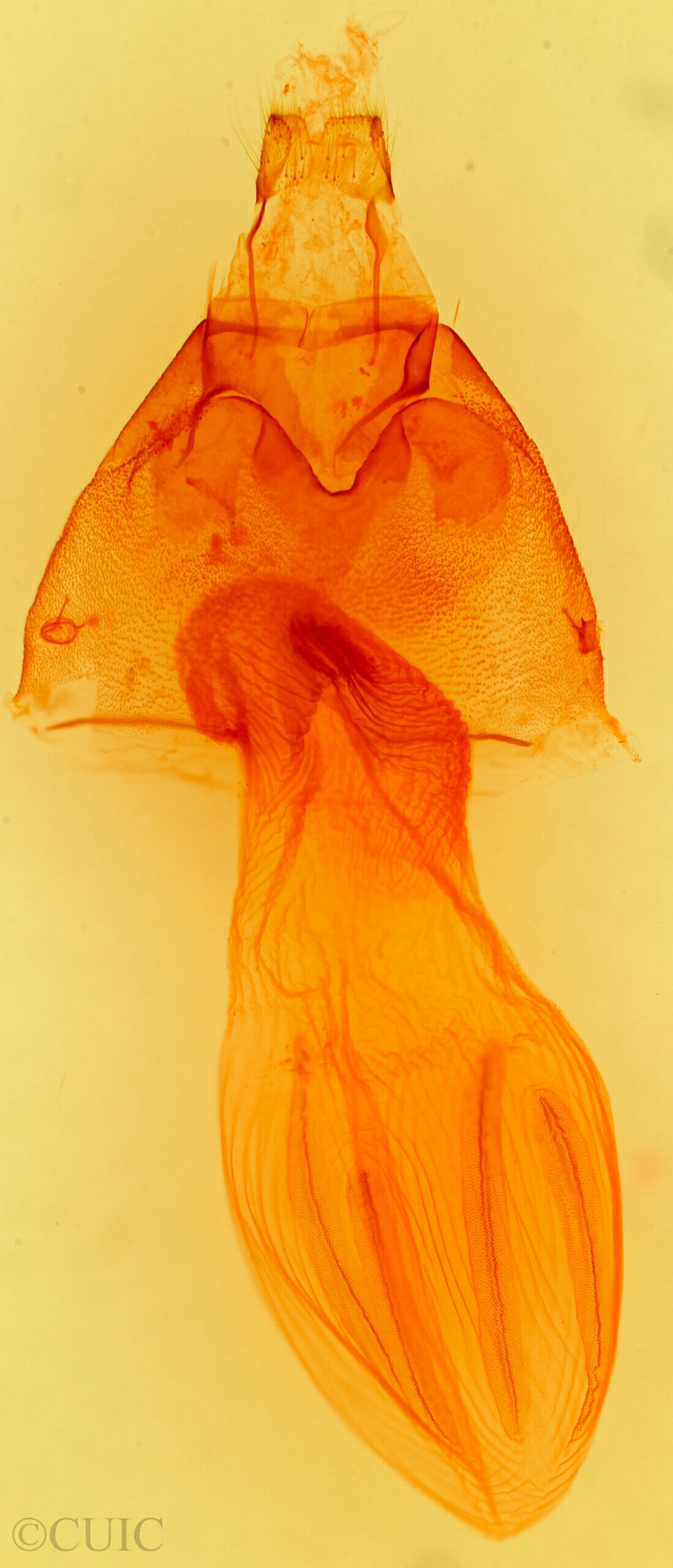 genitalia view of adult Crocigrapha normani