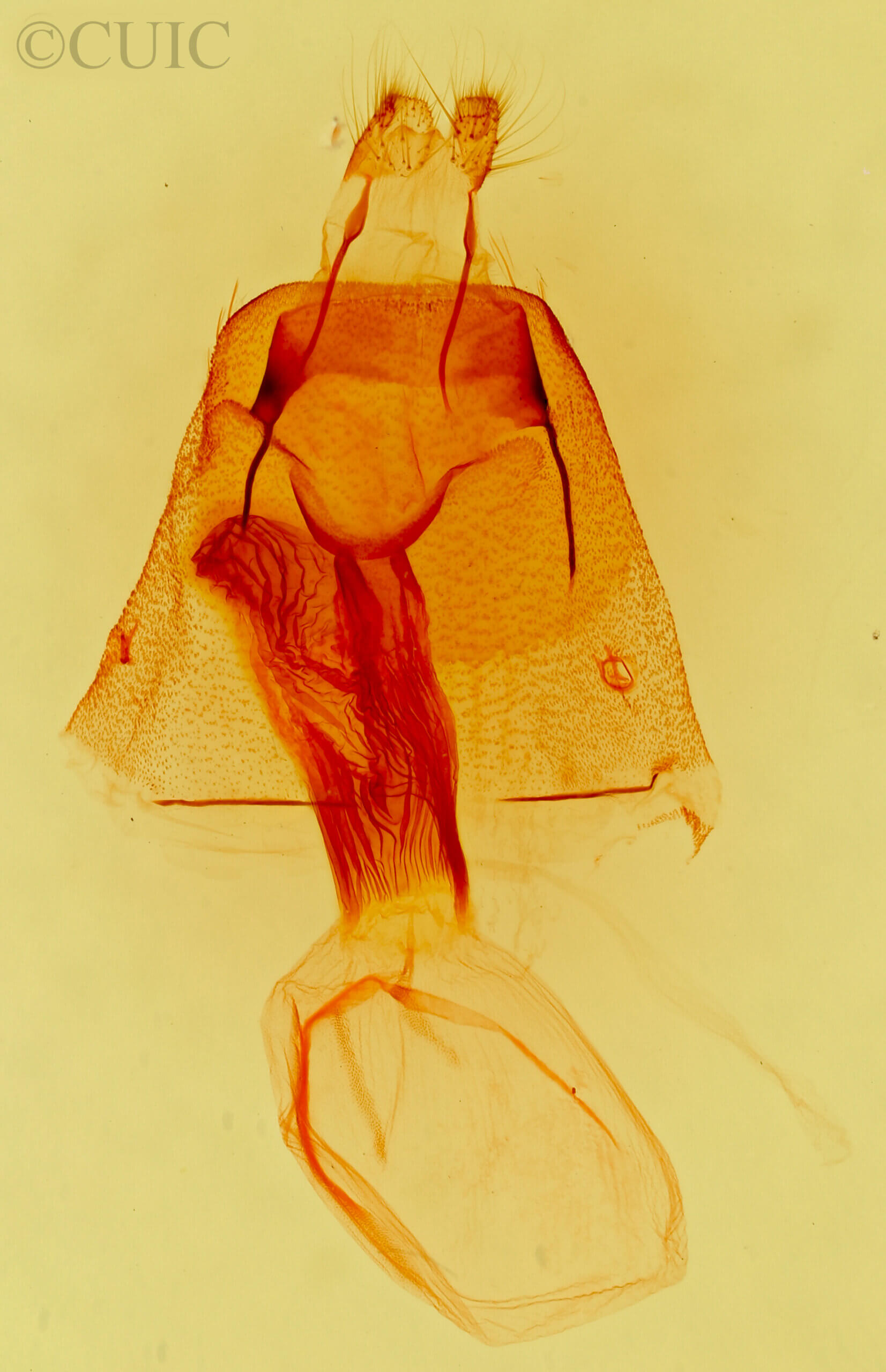 genitalia view of adult Orthimella fidelis