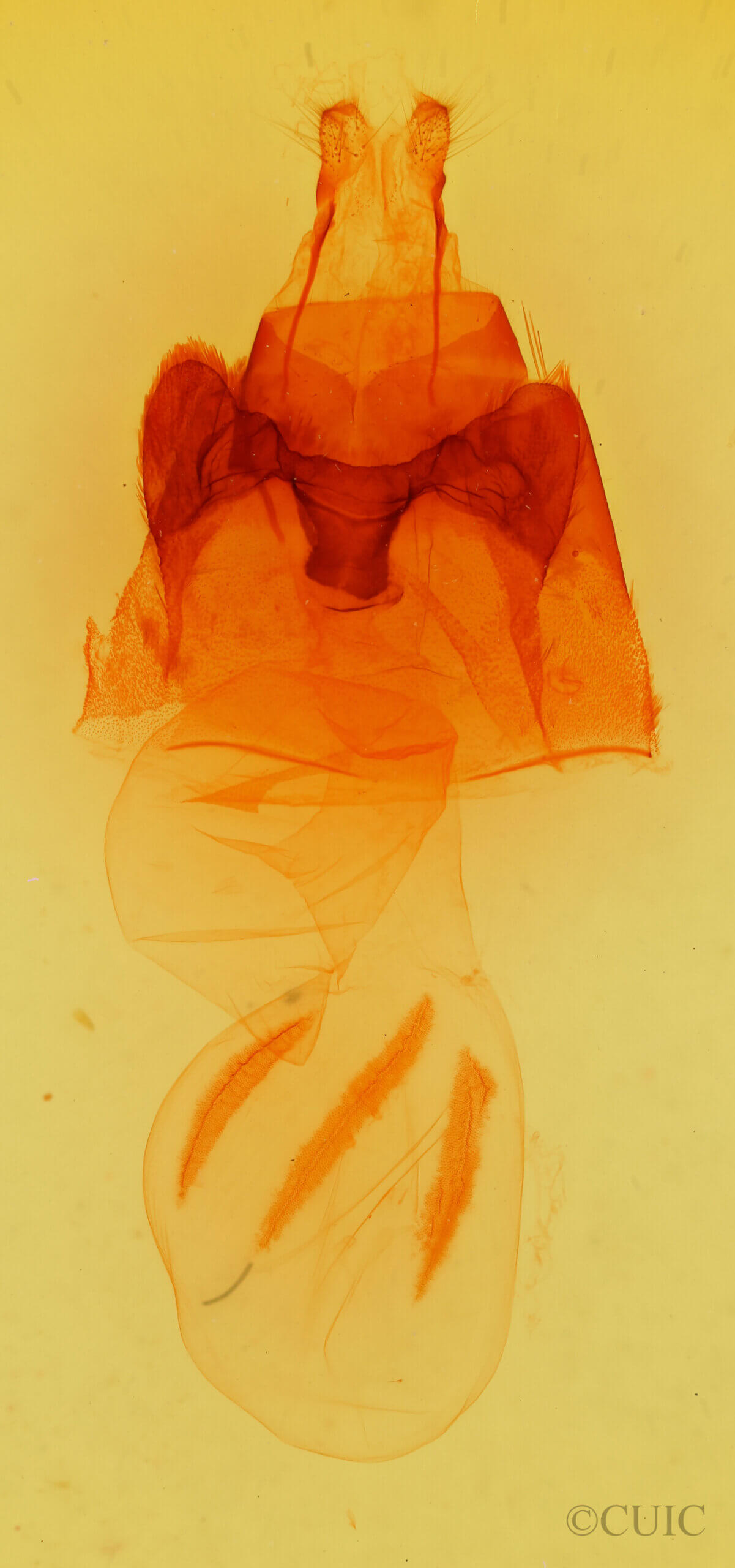 genitalia view of adult Hyppa dysmica n. sp.