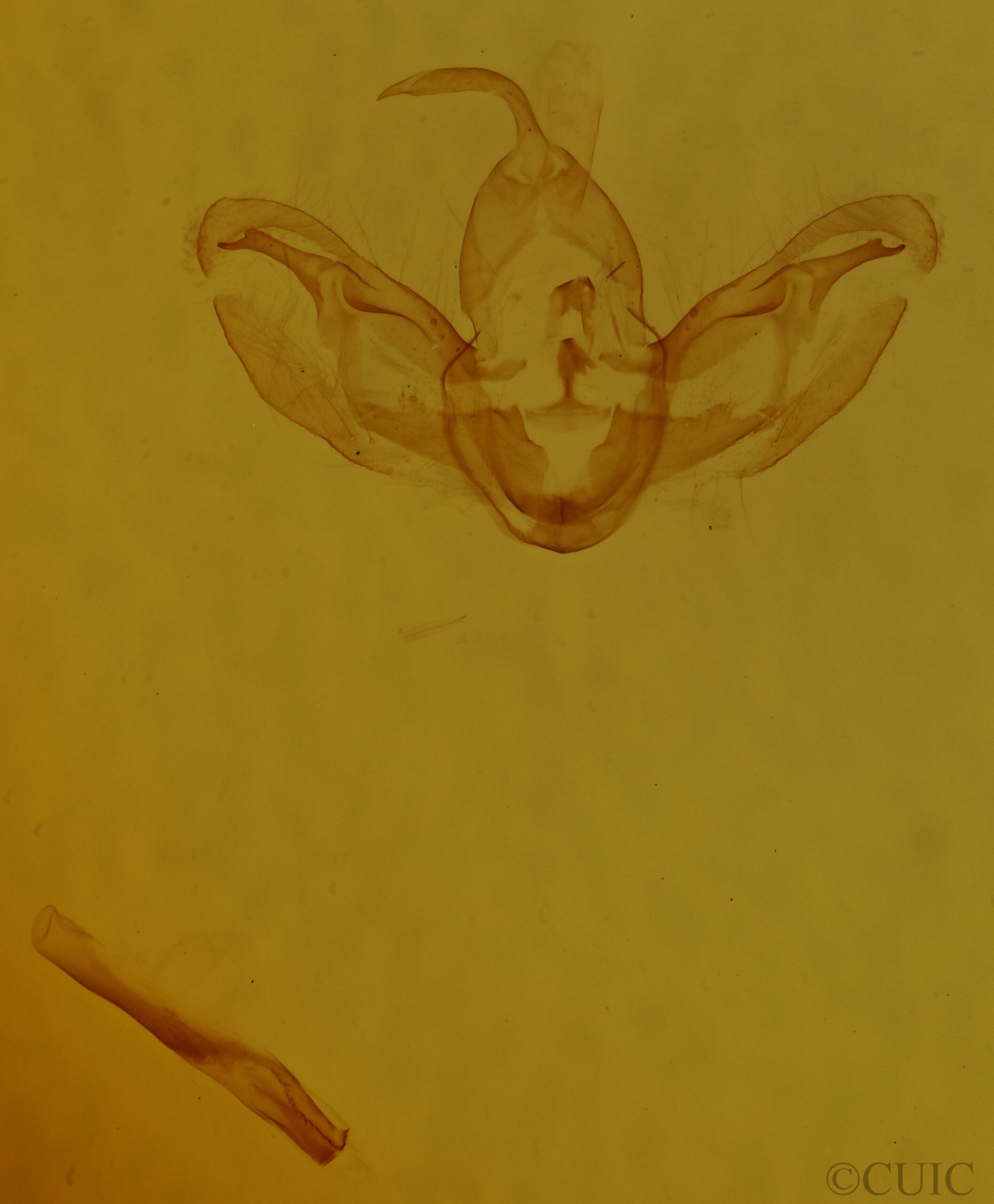 genitalia view of adult Spodoptera deprivata
