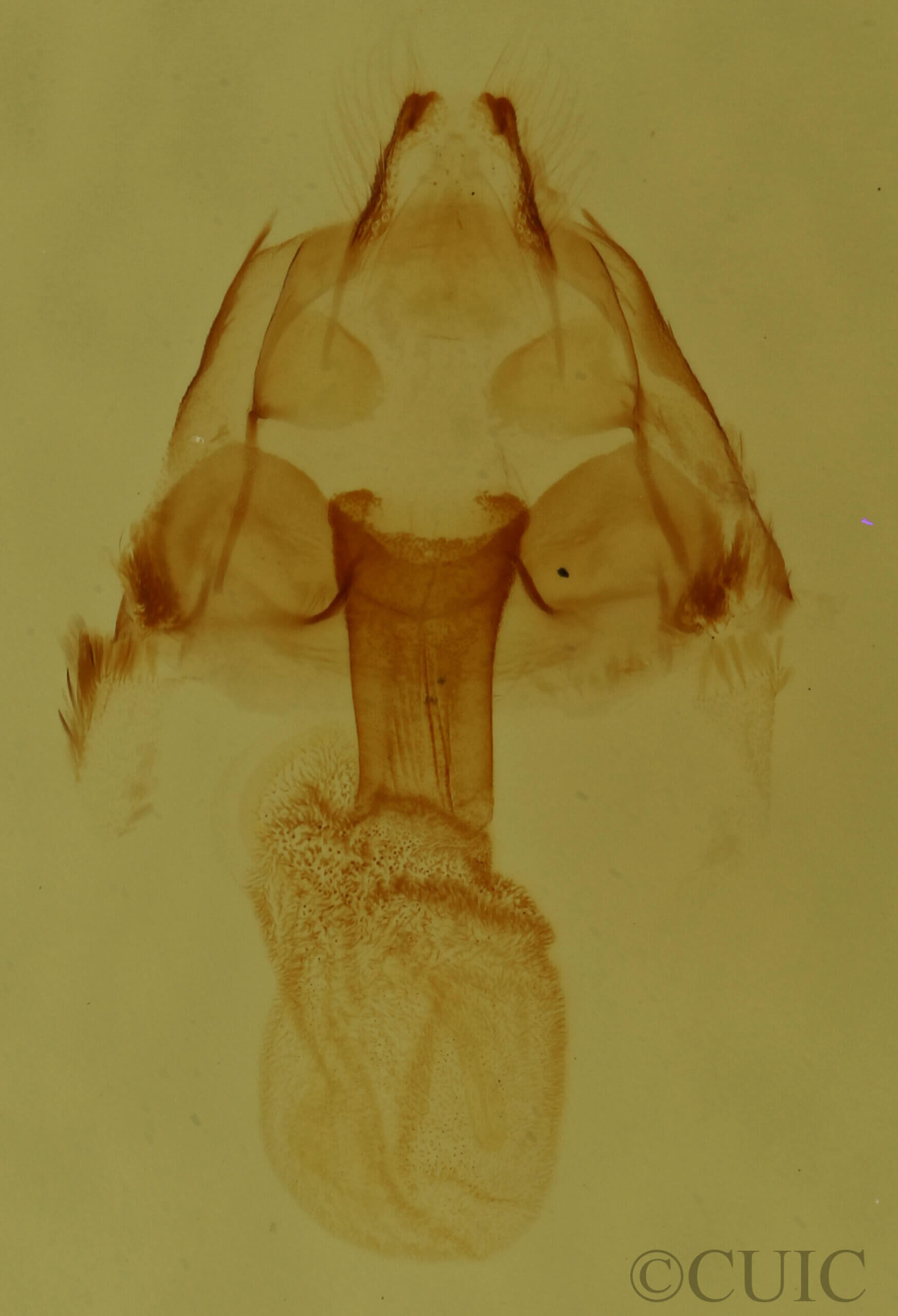 genitalia view of adult Hyperstrotia nana