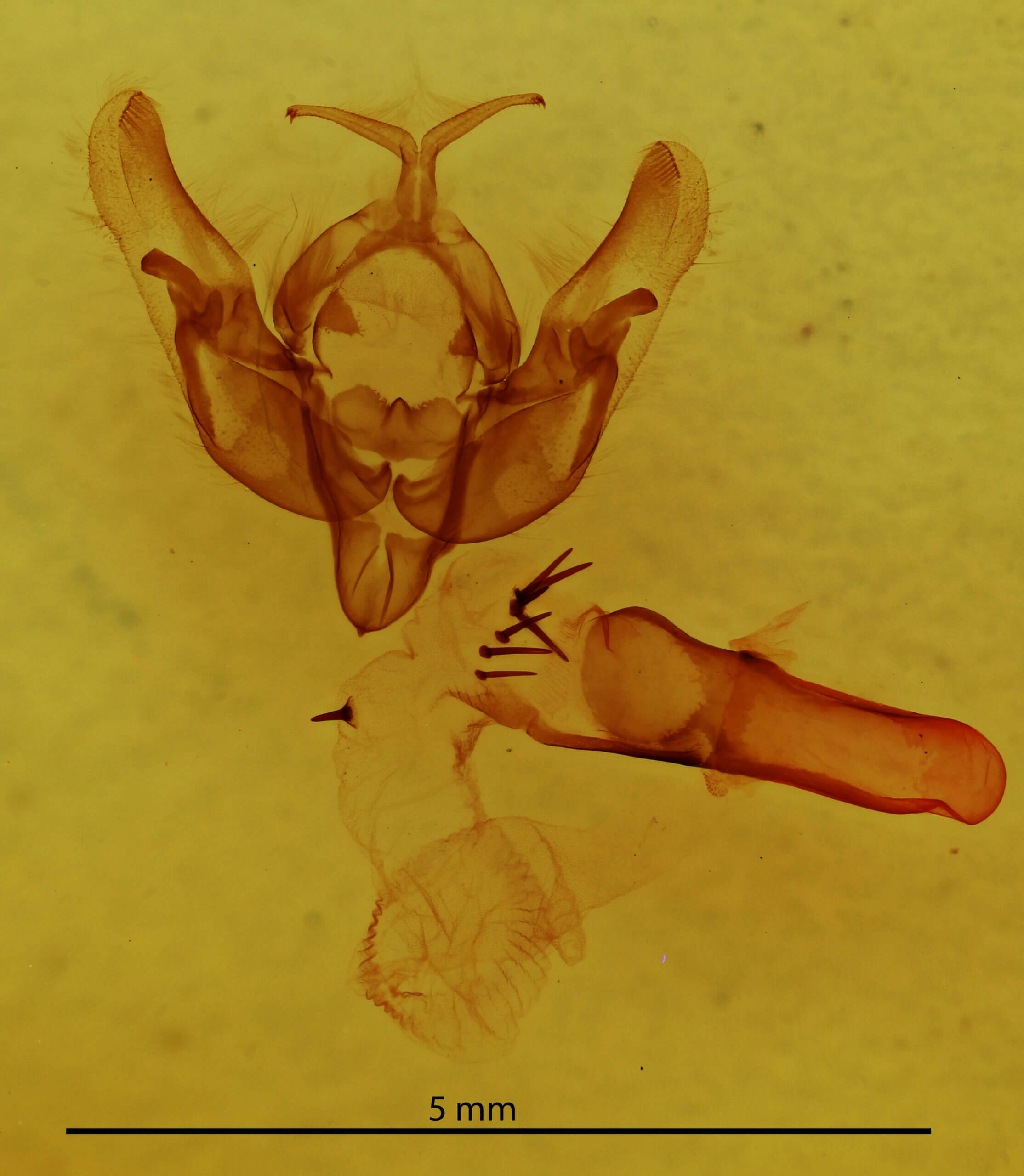 genitalia view of adult Hemieuxoa mendosica