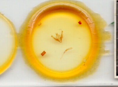 slide view of adult Hypotrix optima