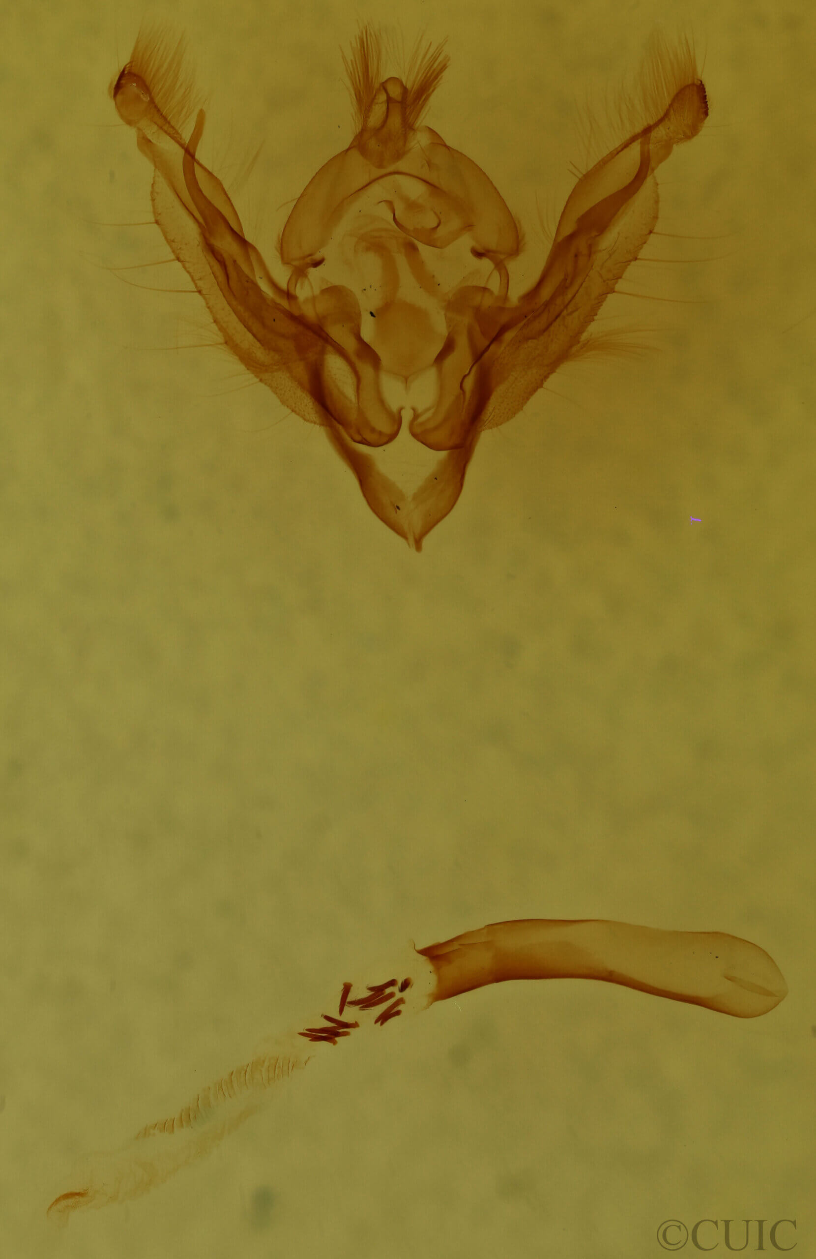 genitalia view of adult Hypotrix optima