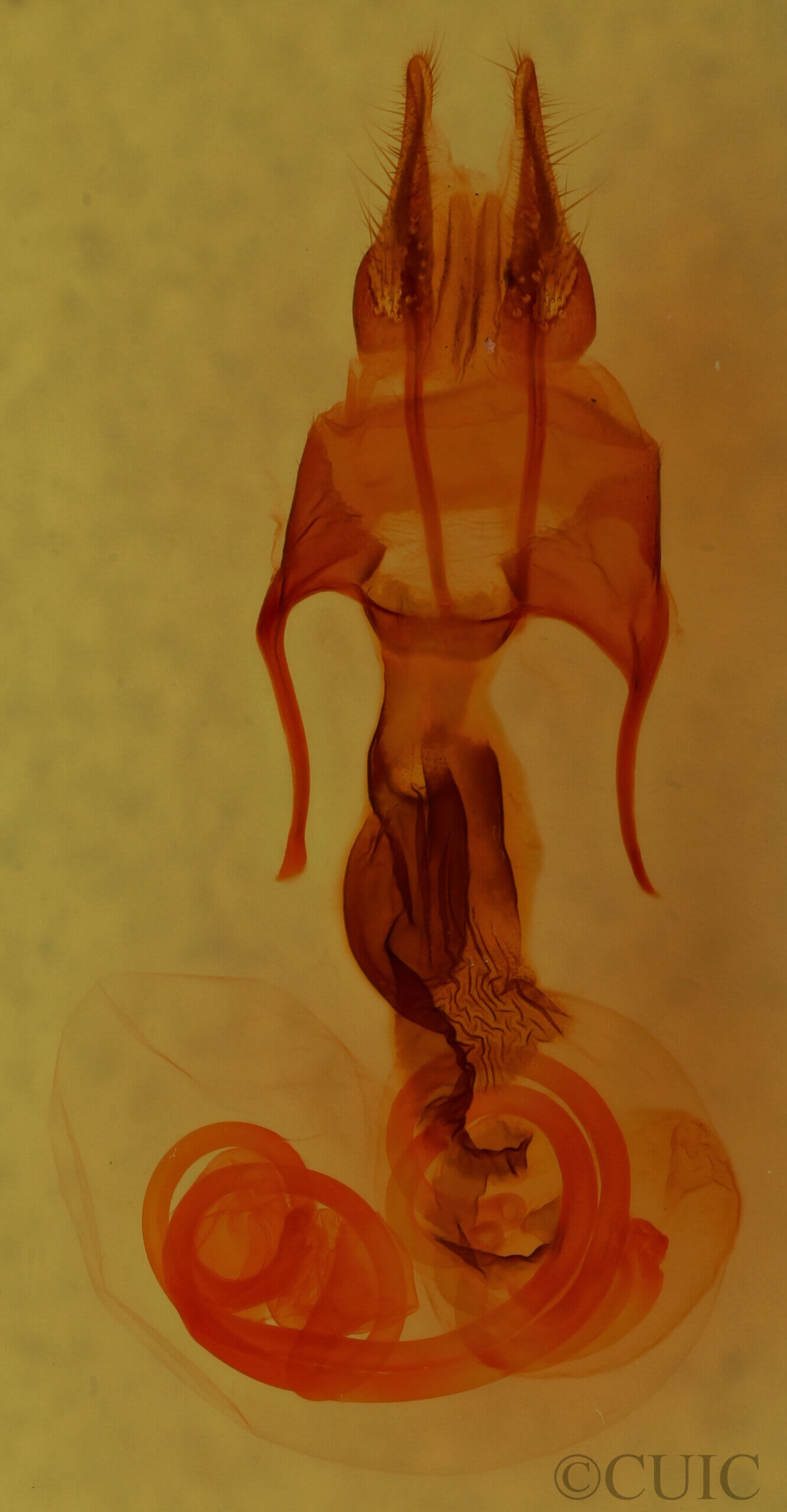 genitalia view of adult Hypotrix optima