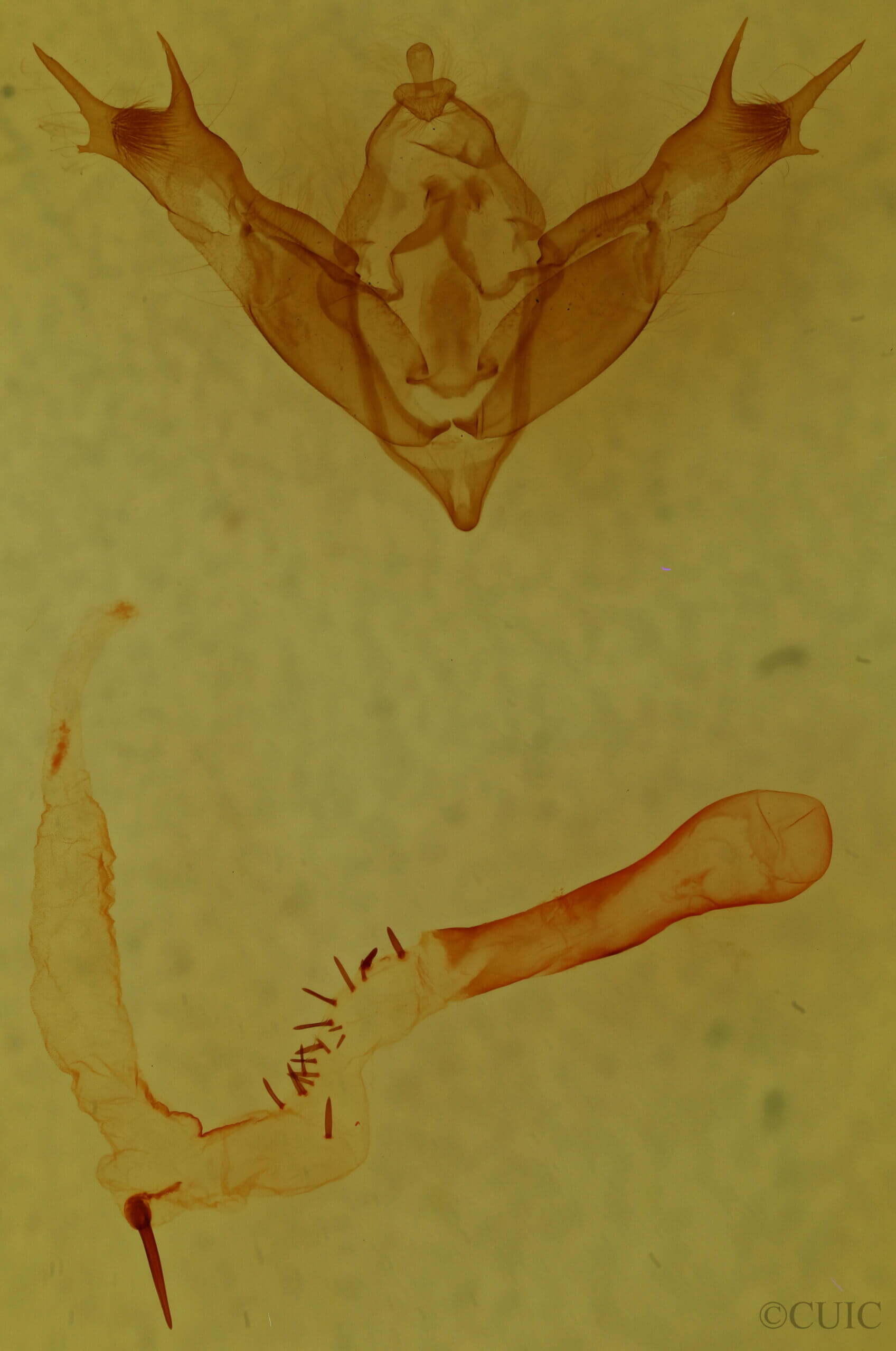genitalia view of adult Anhimella sp.