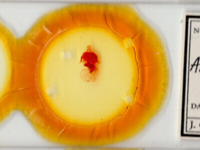 slide view of adult Anhimella sp.