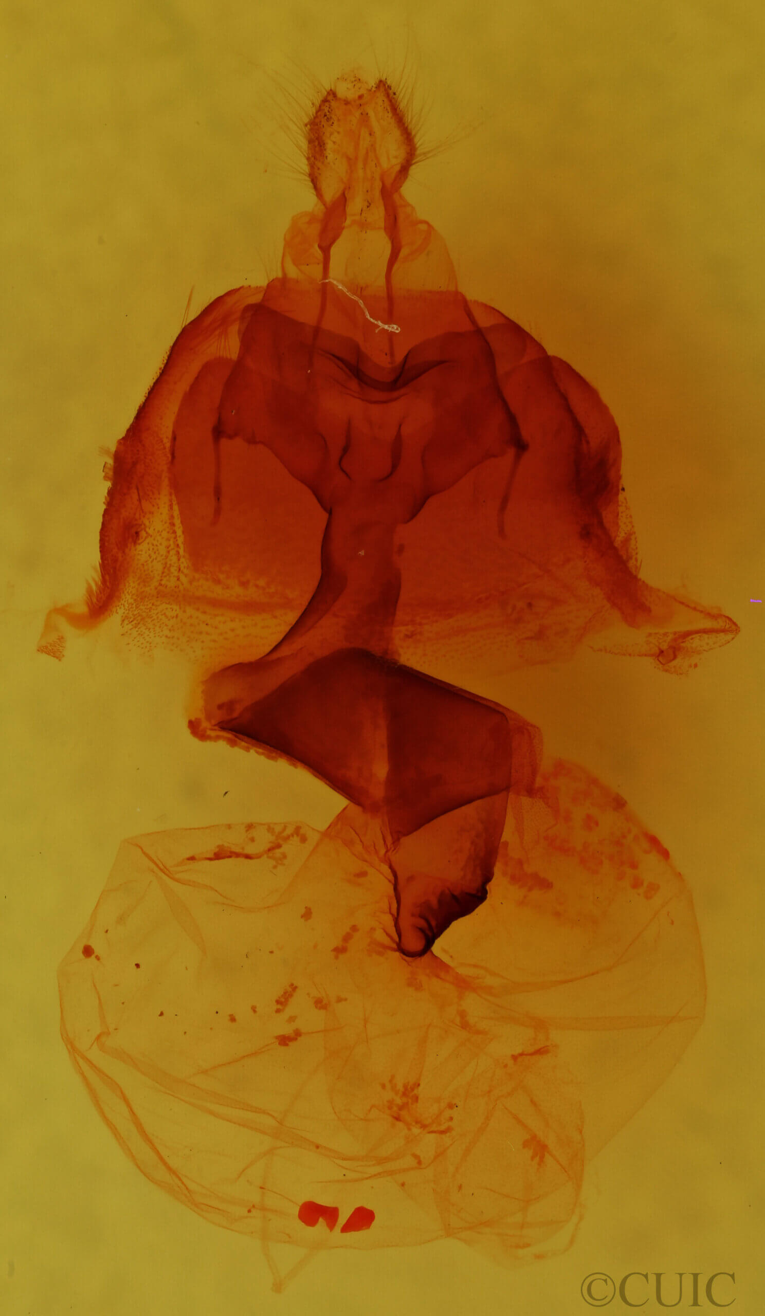 genitalia view of adult Anhimella sp.