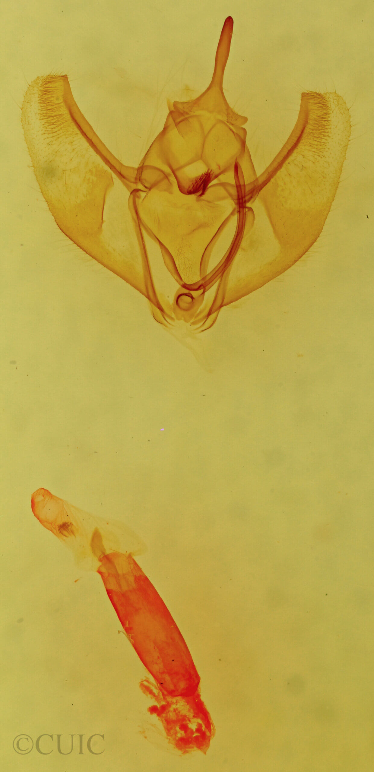 genitalia view of adult Caripeta interalbicans