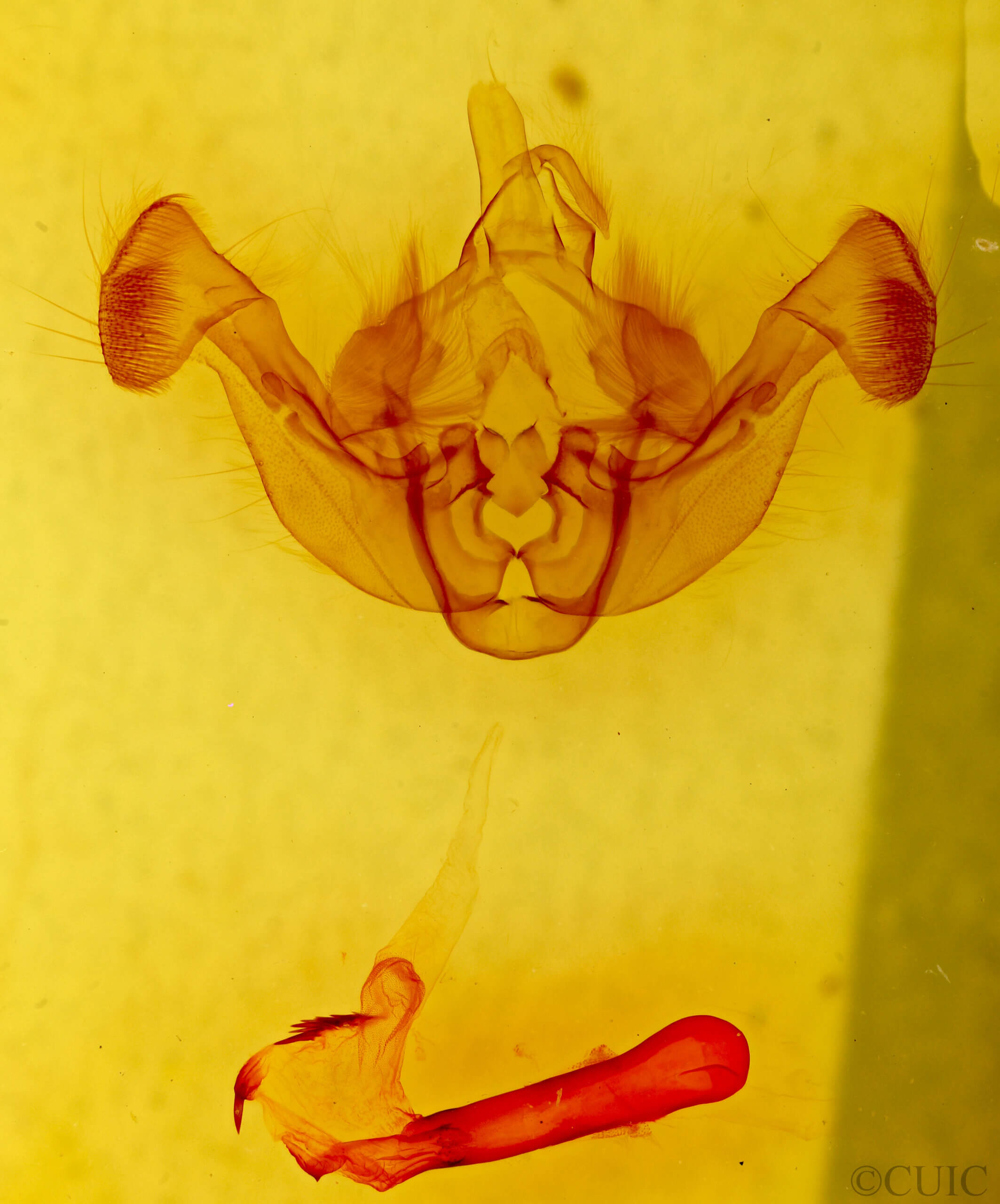 genitalia view of adult Luperina sp.