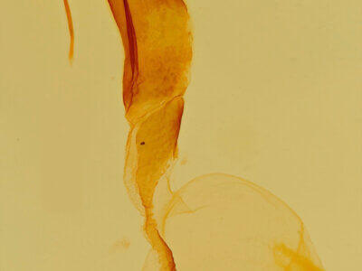 genitalia view of adult Lacinipolia explicata