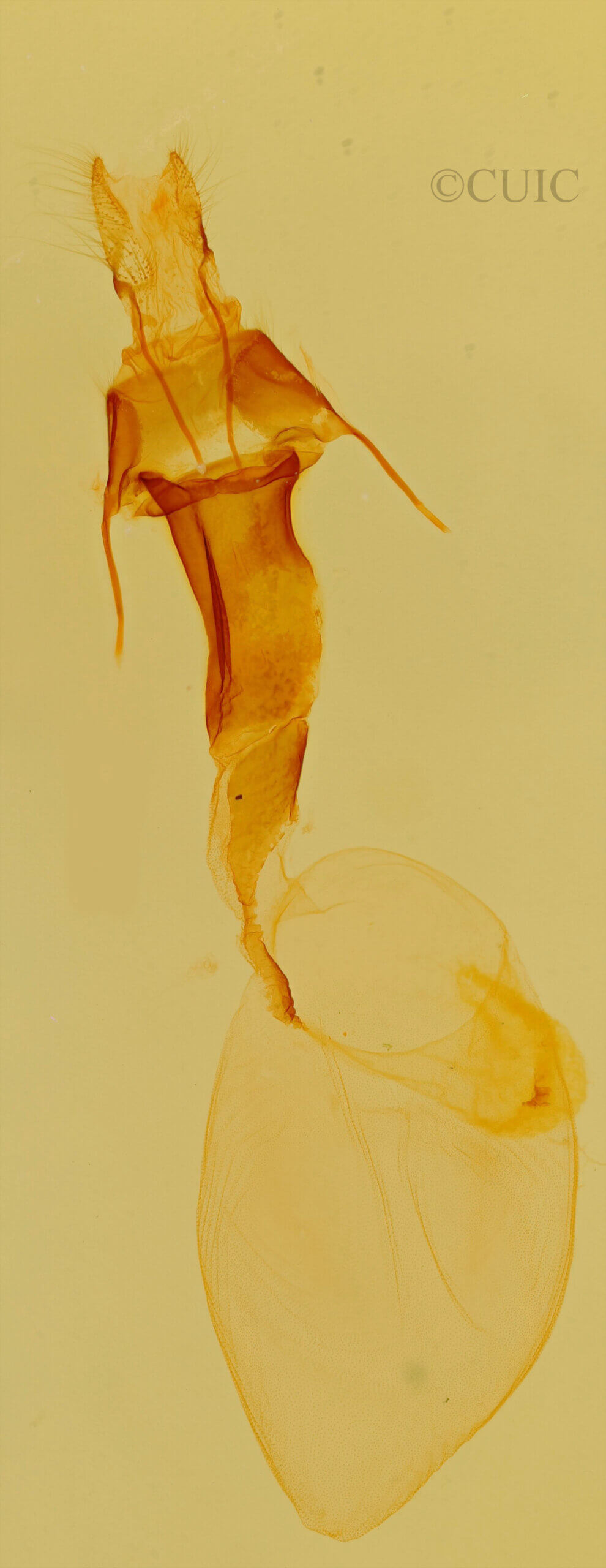 genitalia view of adult Lacinipolia explicata