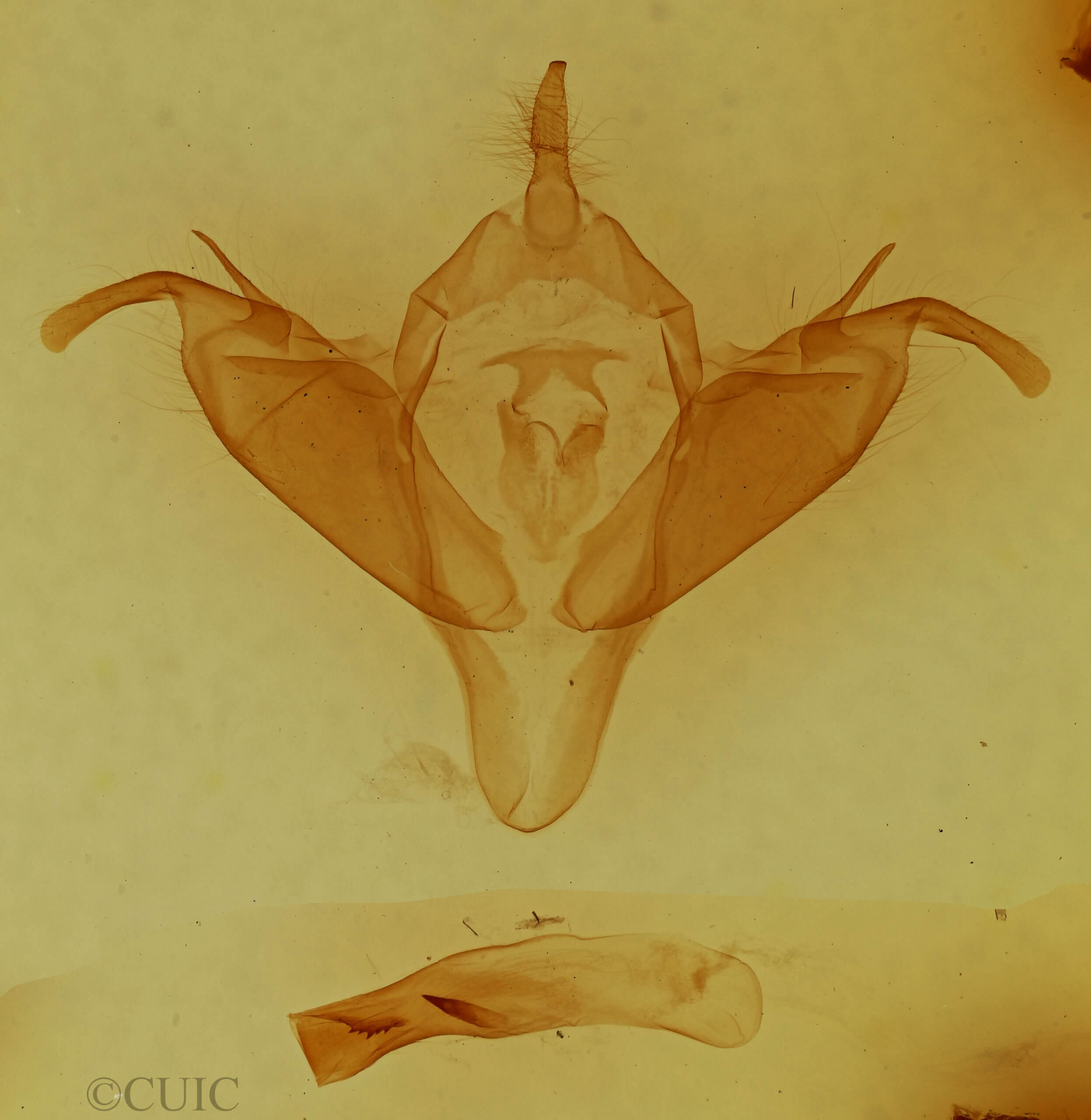 genitalia view of adult Abagrotis sp.