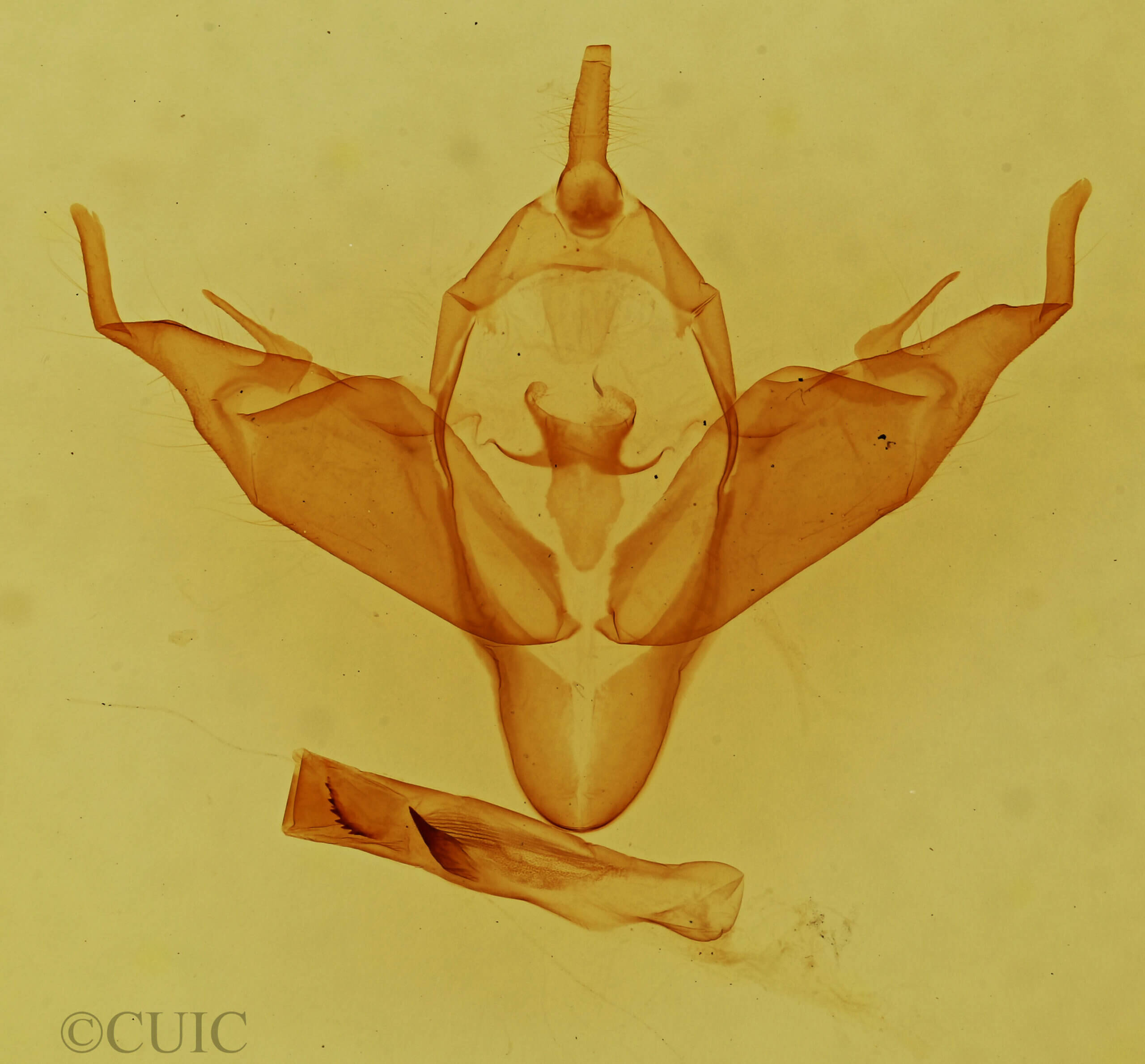 genitalia view of adult Abagrotis sp.