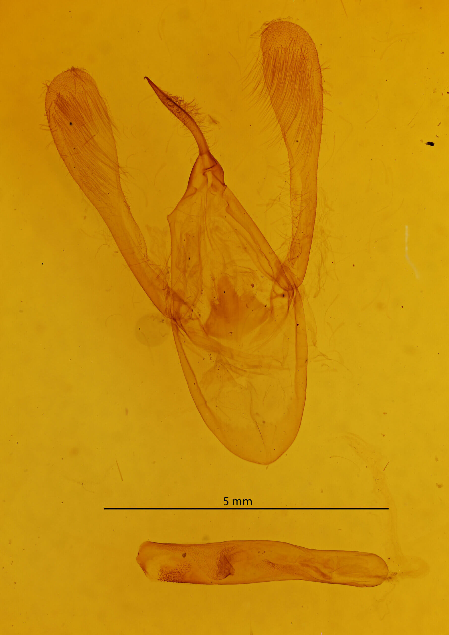 genitalia view of adult Agape sp.