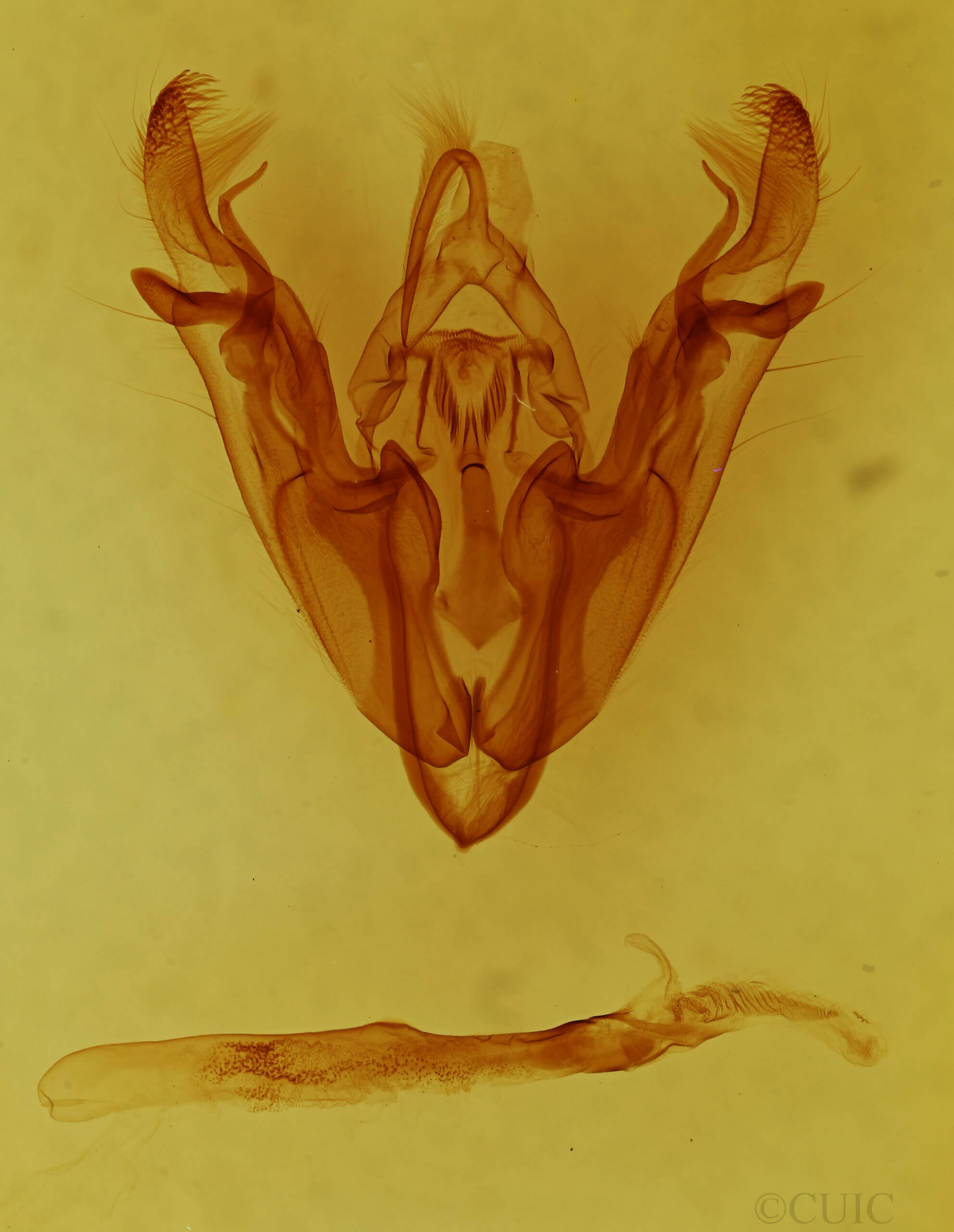 genitalia view of adult Protorthodes sp.