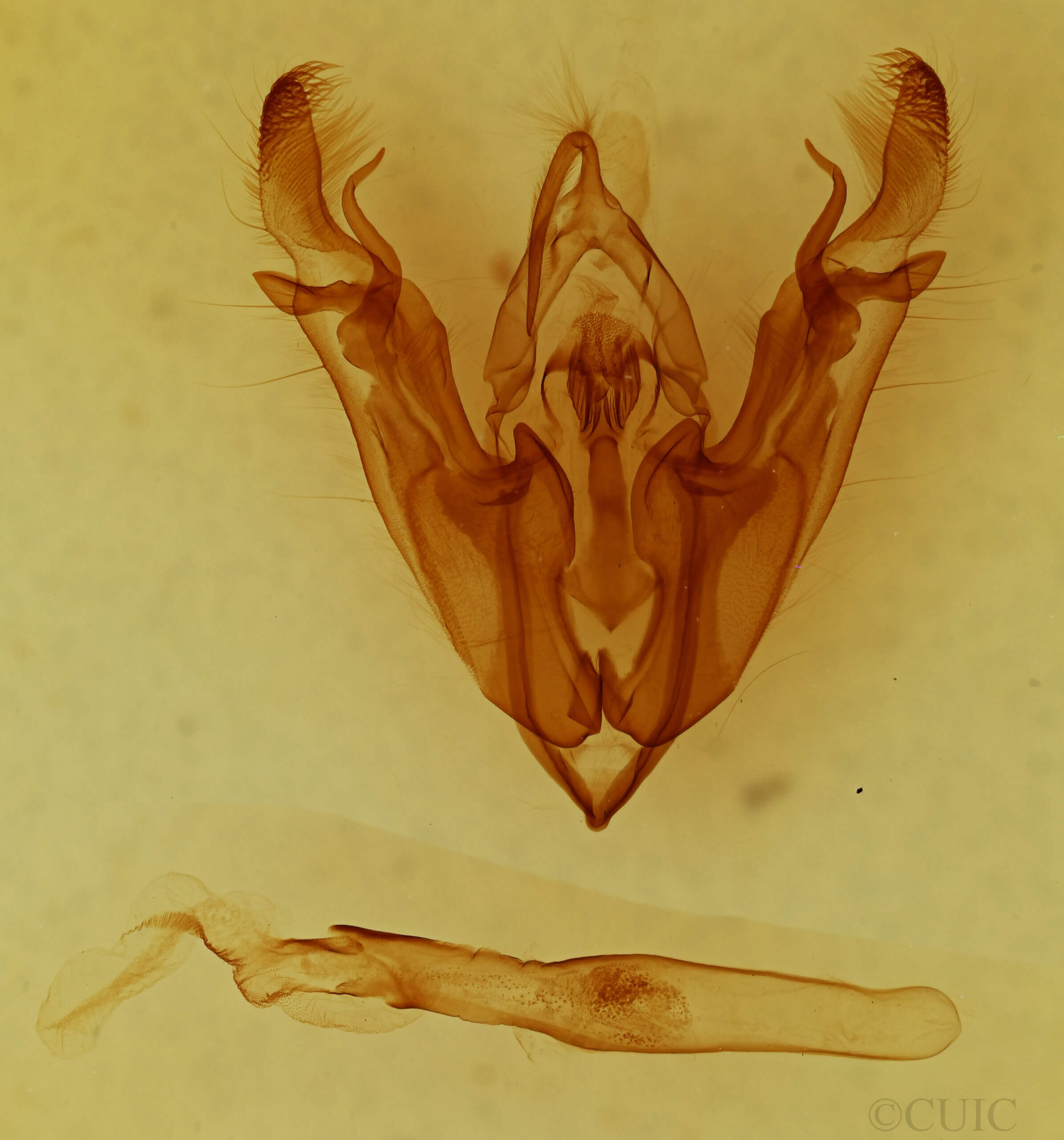 genitalia view of adult Protorthodes sp.