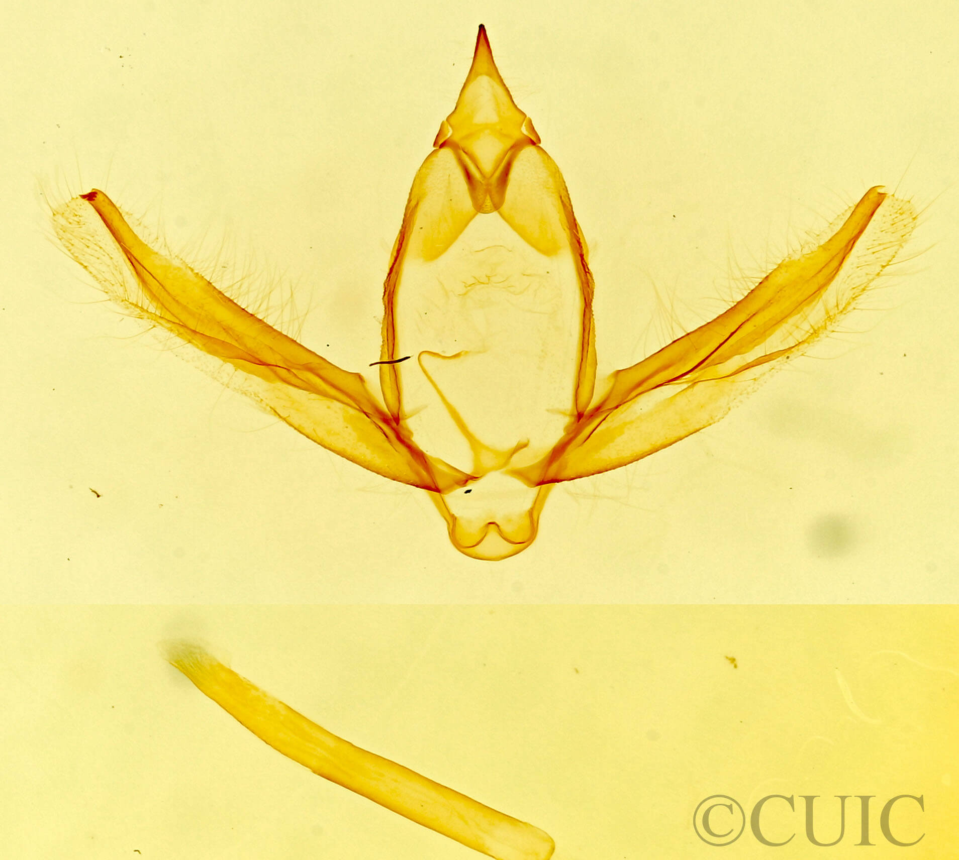genitalia view of adult Stenoporpia mediatra?