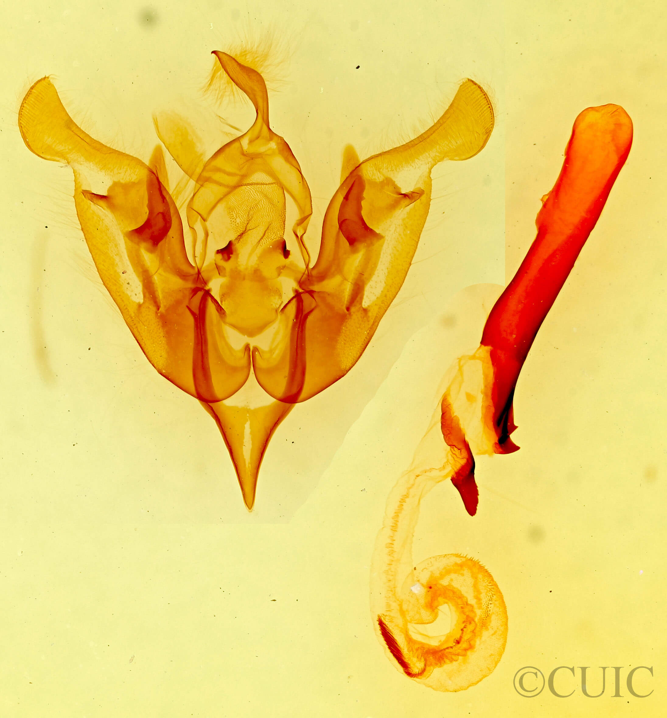 genitalia view of adult Lacinipolia sp.