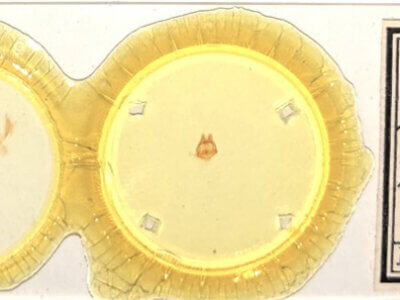 slide view of adult Tecmessa scitiscripta