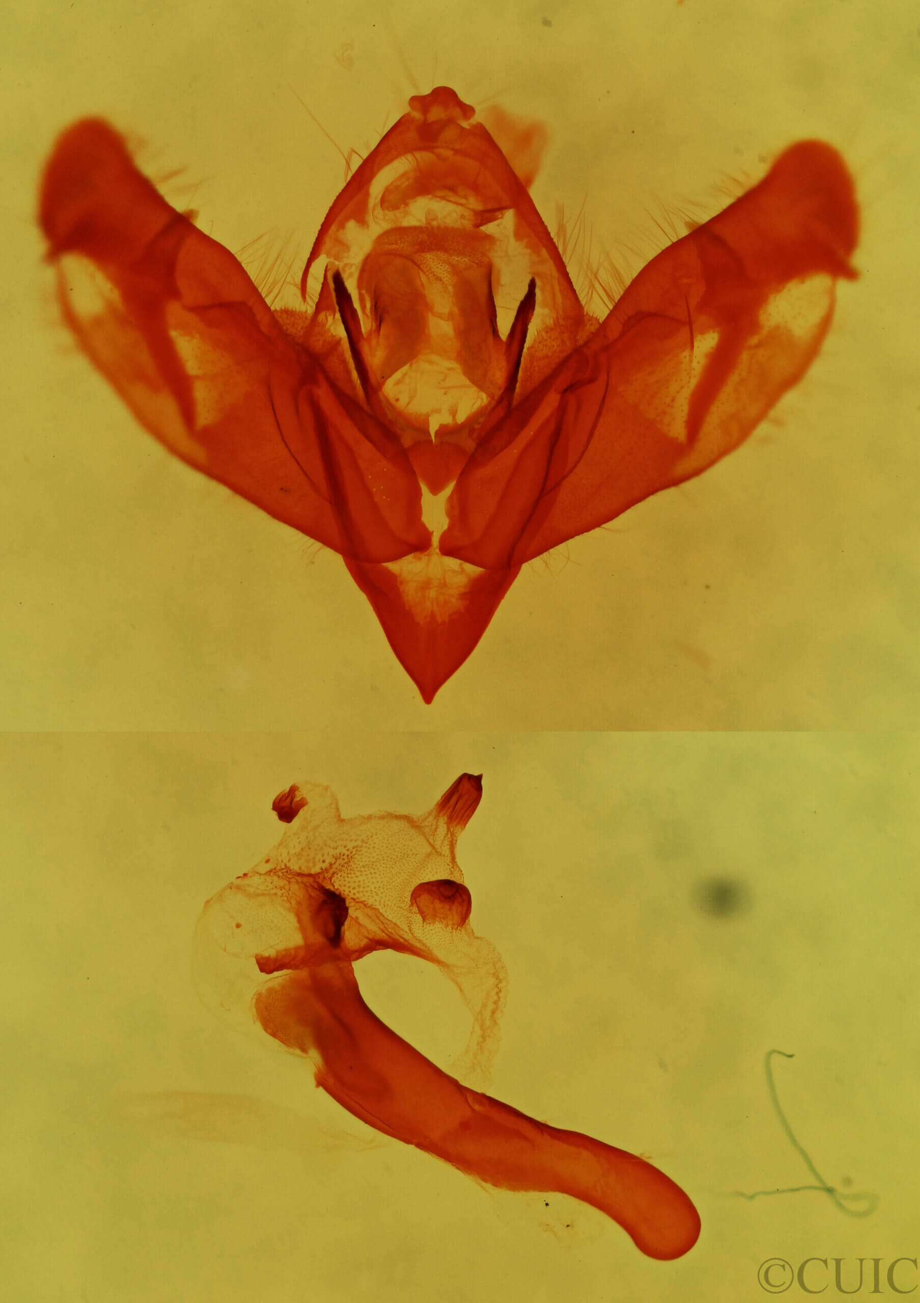 genitalia view of adult Nedra stewarti