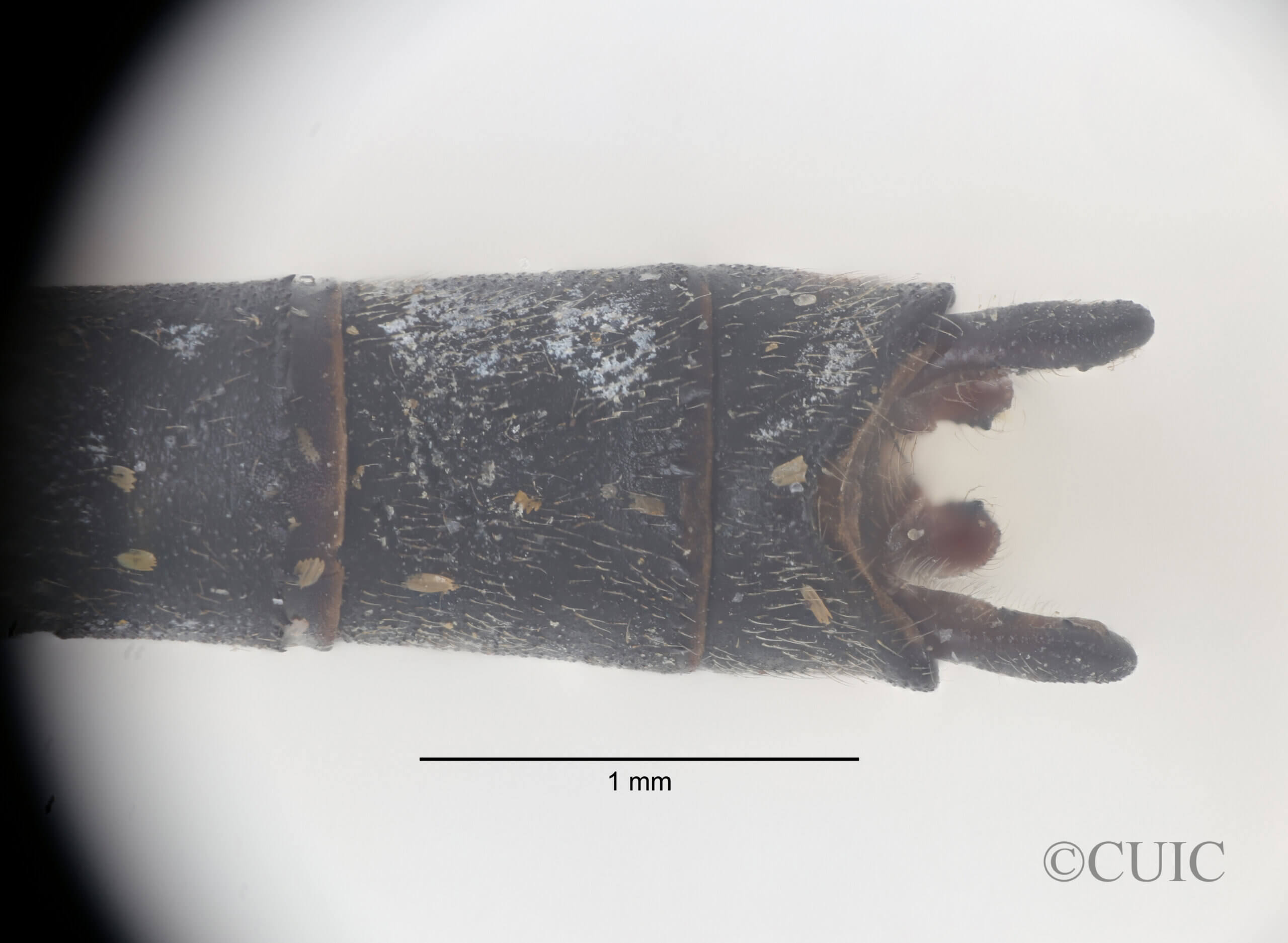 Dorsal view of genitalia