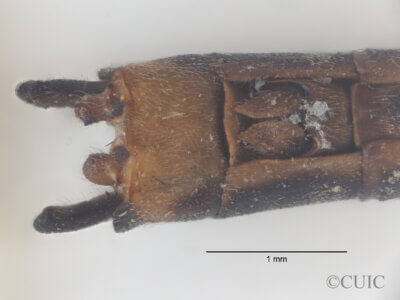 Ventral view of genitalia