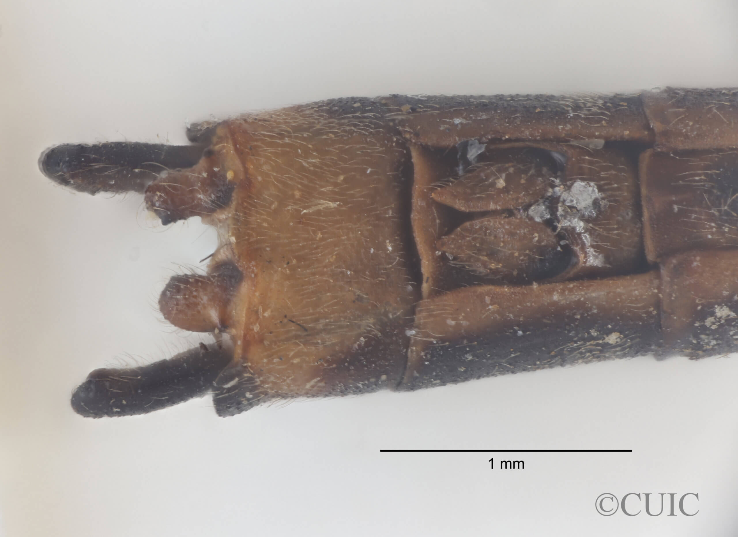 Ventral view of genitalia